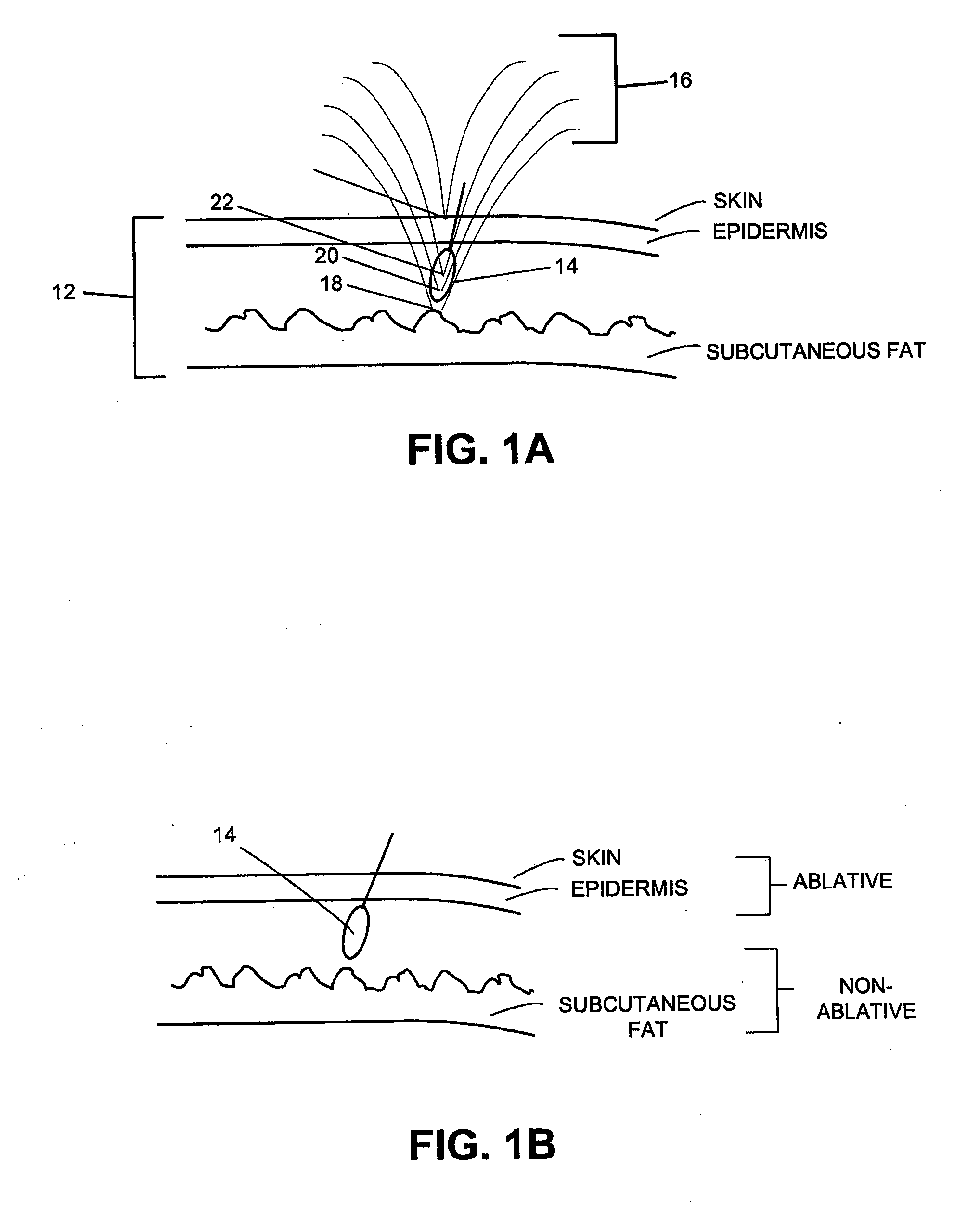Method and system for combined energy therapy profile