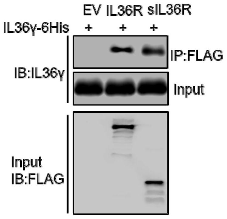 Soluble receptor sIL-36R of IL-36 and application of soluble receptor sIL-36R