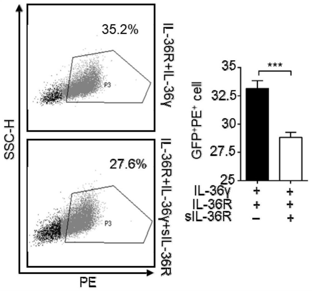 Soluble receptor sIL-36R of IL-36 and application of soluble receptor sIL-36R