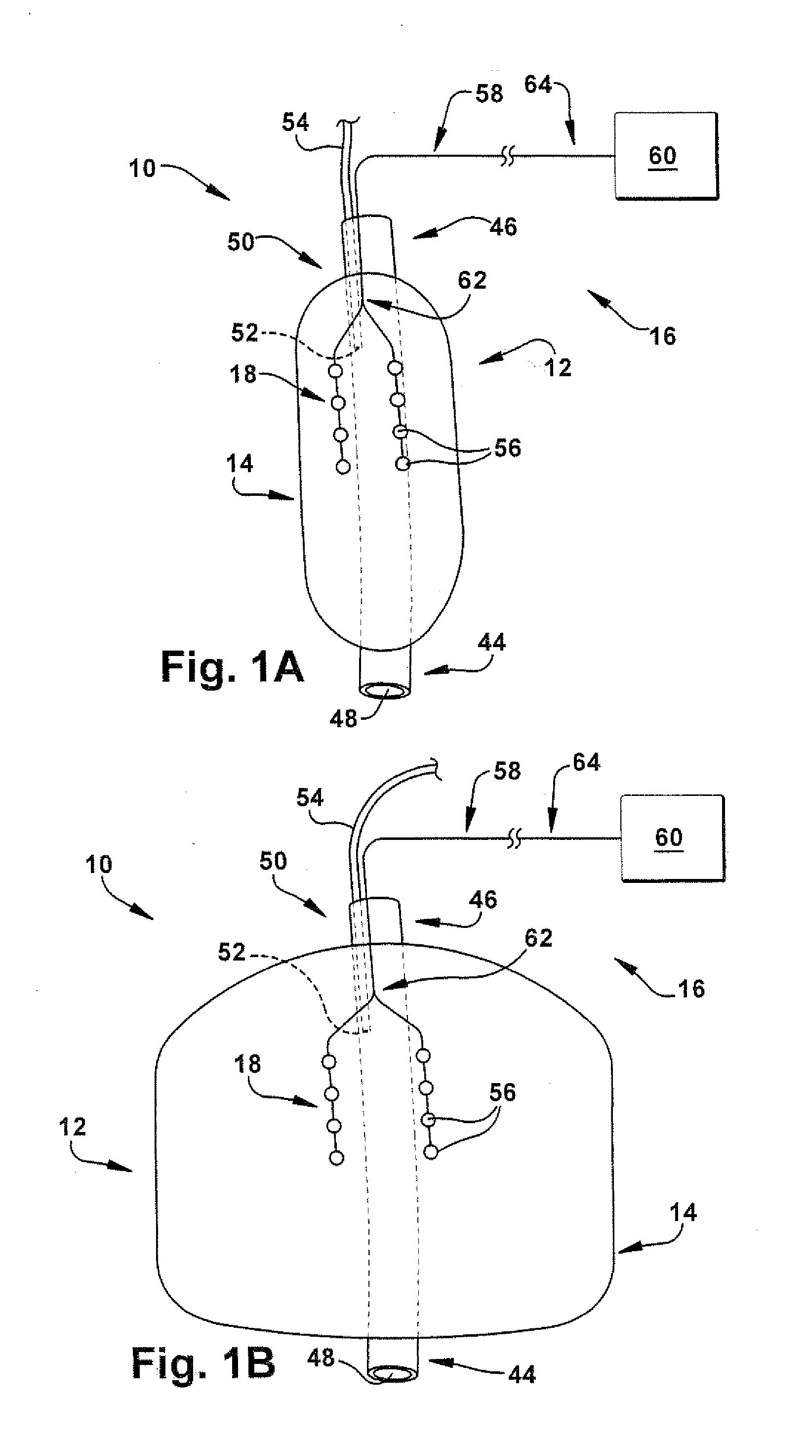 Apparatus and method for treating pulmonary conditions