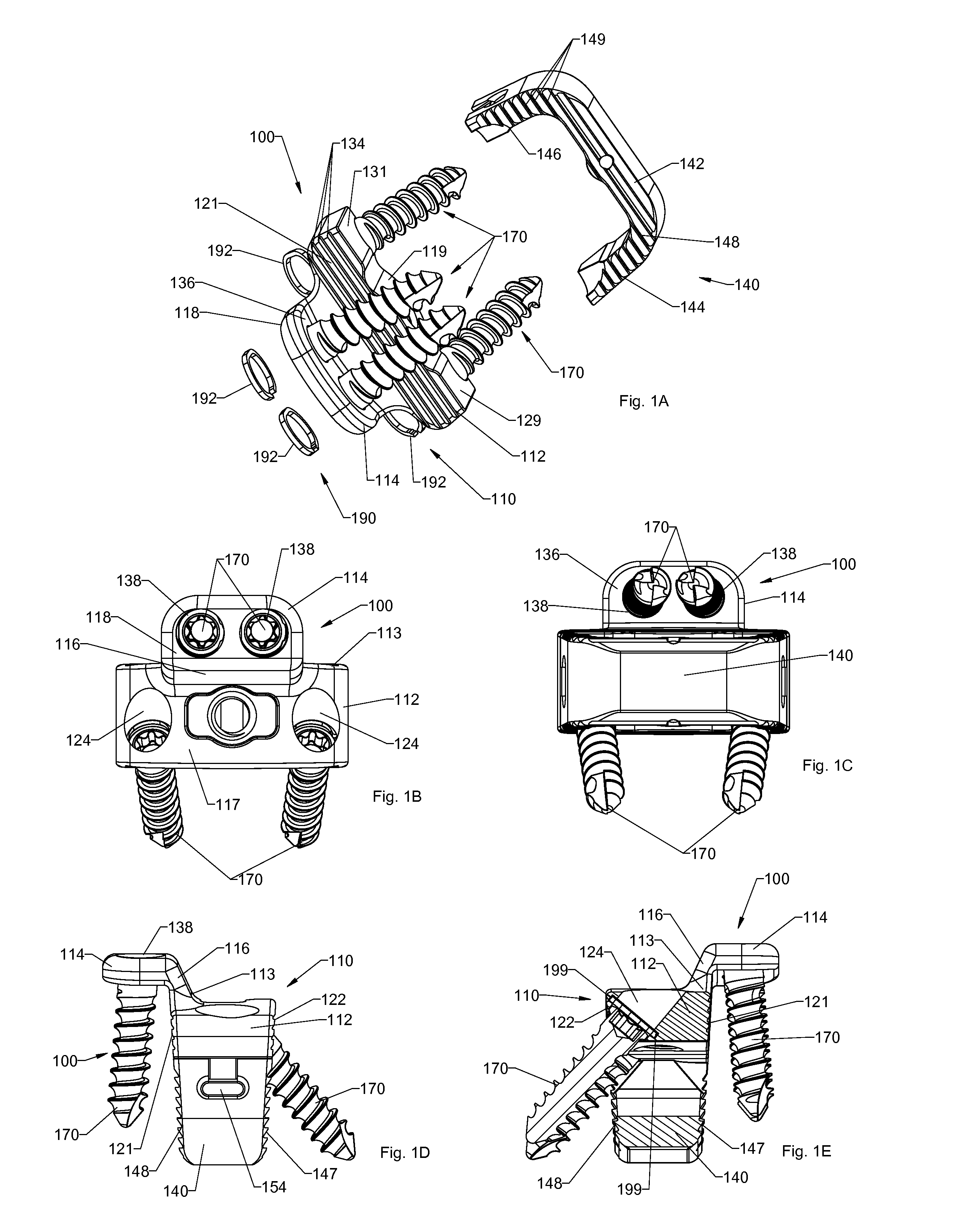 Spinal implants, spinal implant kits, and surgical methods