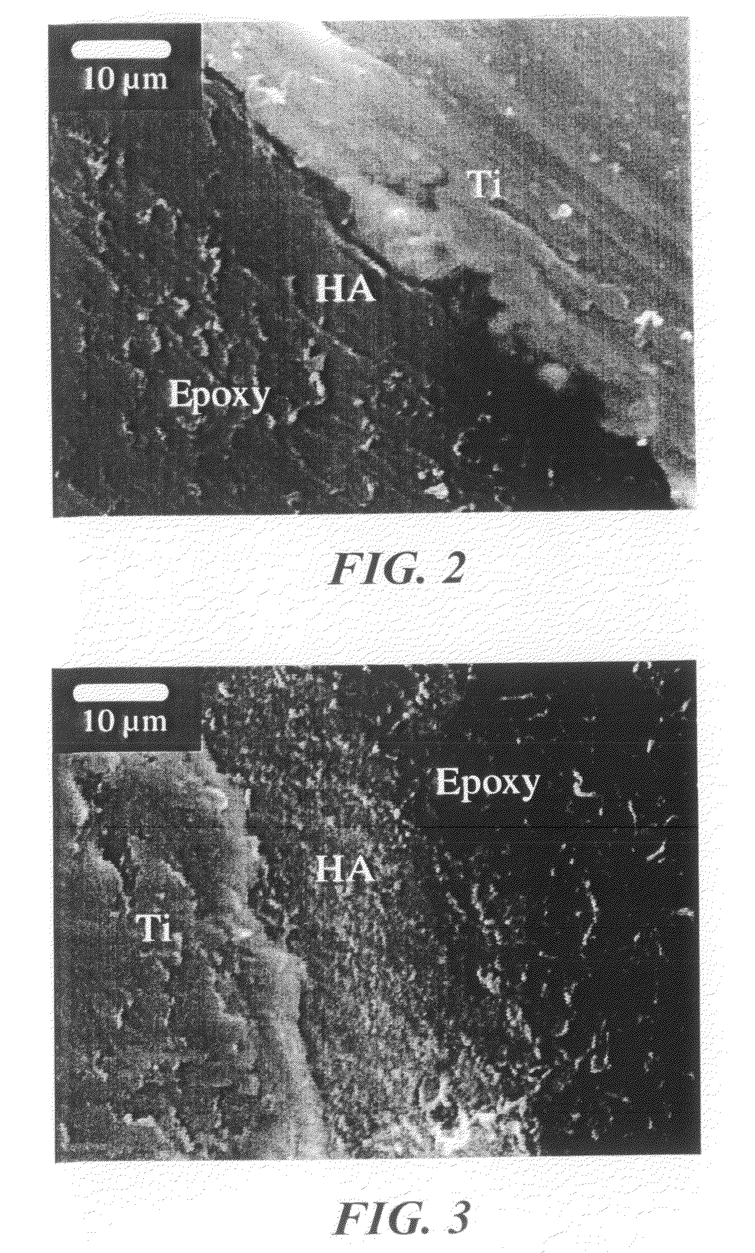 Process for depositing calcium phosphate therapeutic coatings with controlled release rates and a prosthesis coated via the process