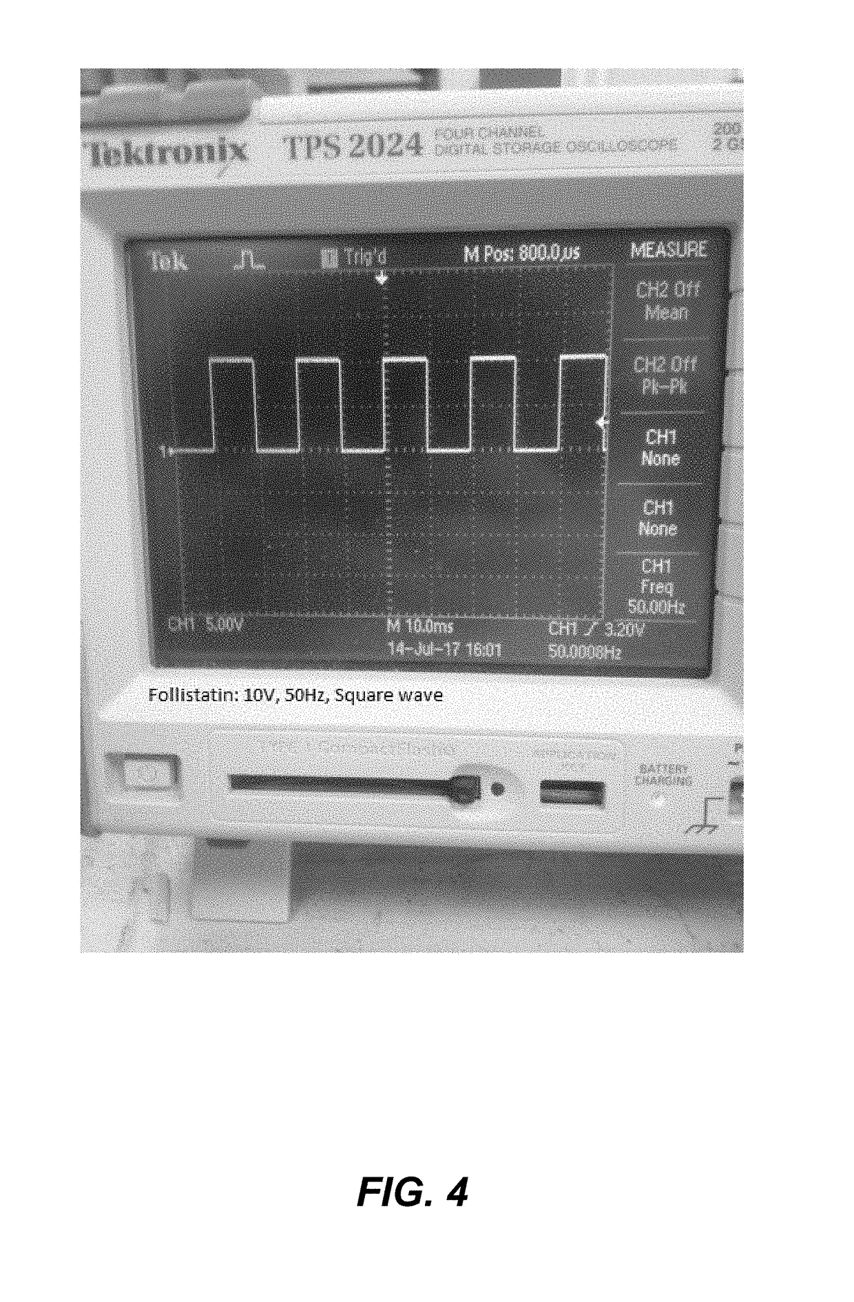 Bioelectric blood pressure management