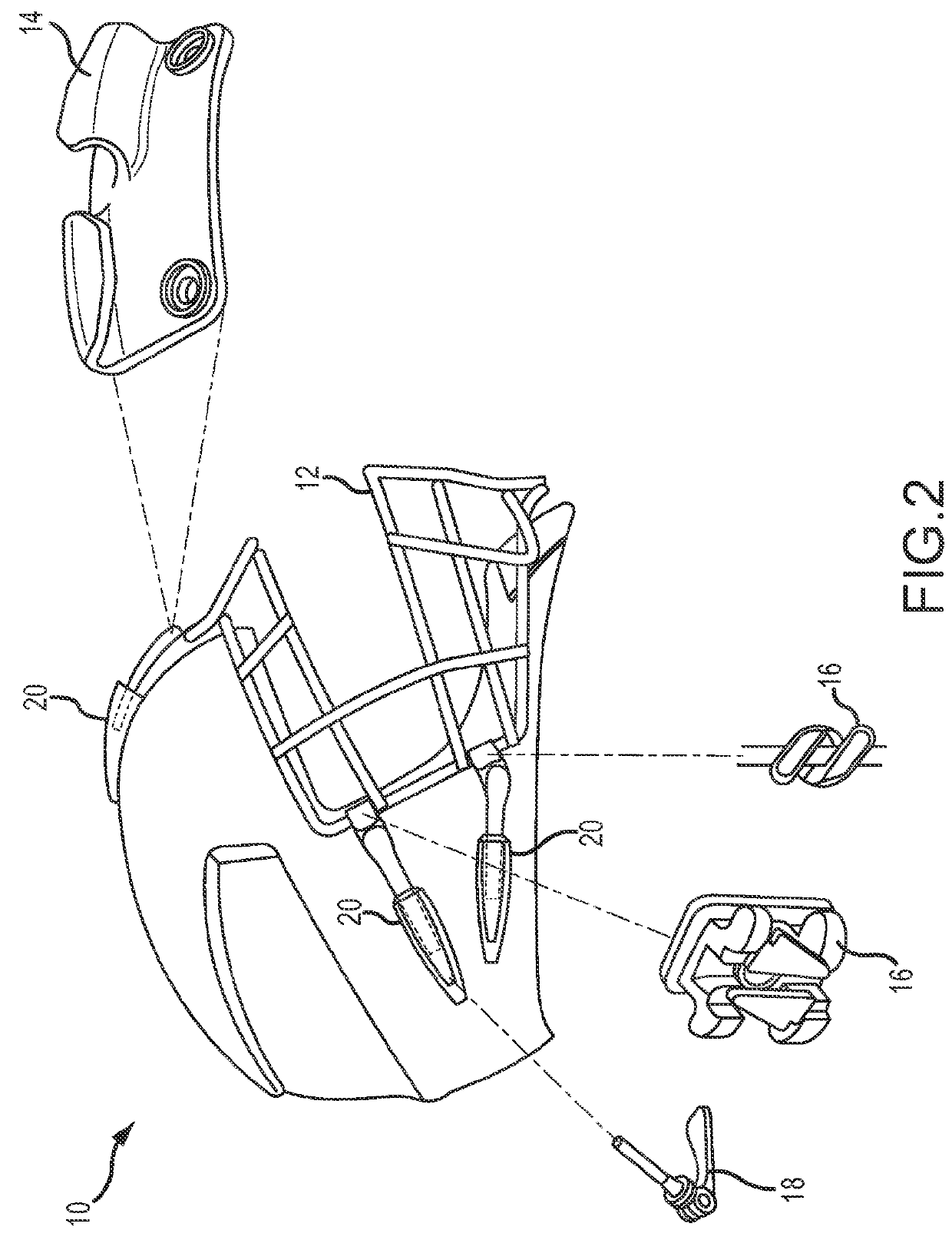 Helmet for Reducing Concussive Forces During Collision and Facilitating Rapid Facemask Removal