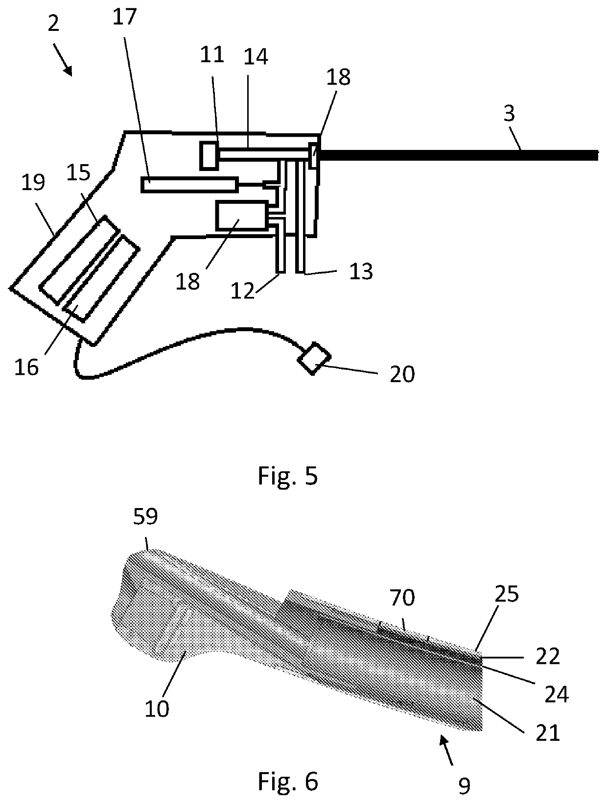 Device for use in hysteroscopy