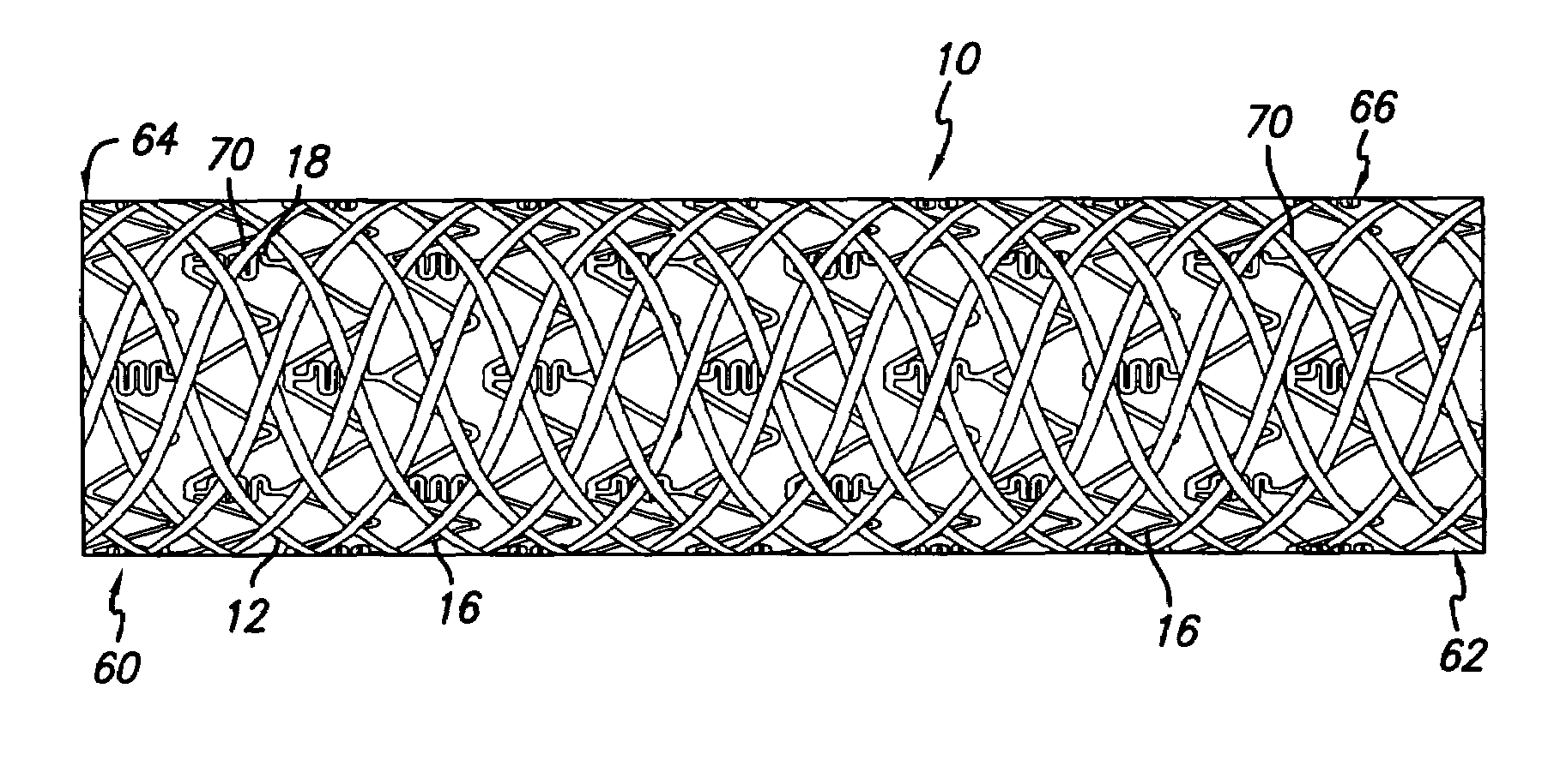 Drug-eluting stent cover and method of use
