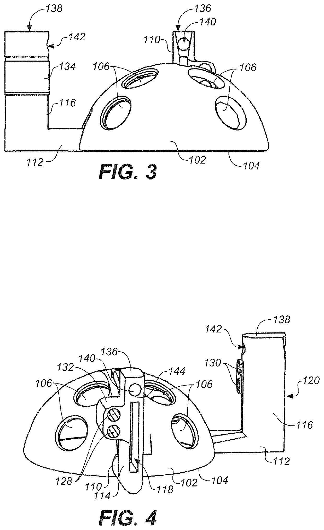 Bone cutting guide system for osteochondral transplantation