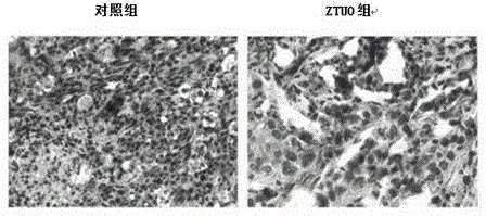 ph selective anti-tumor polypeptide and its application