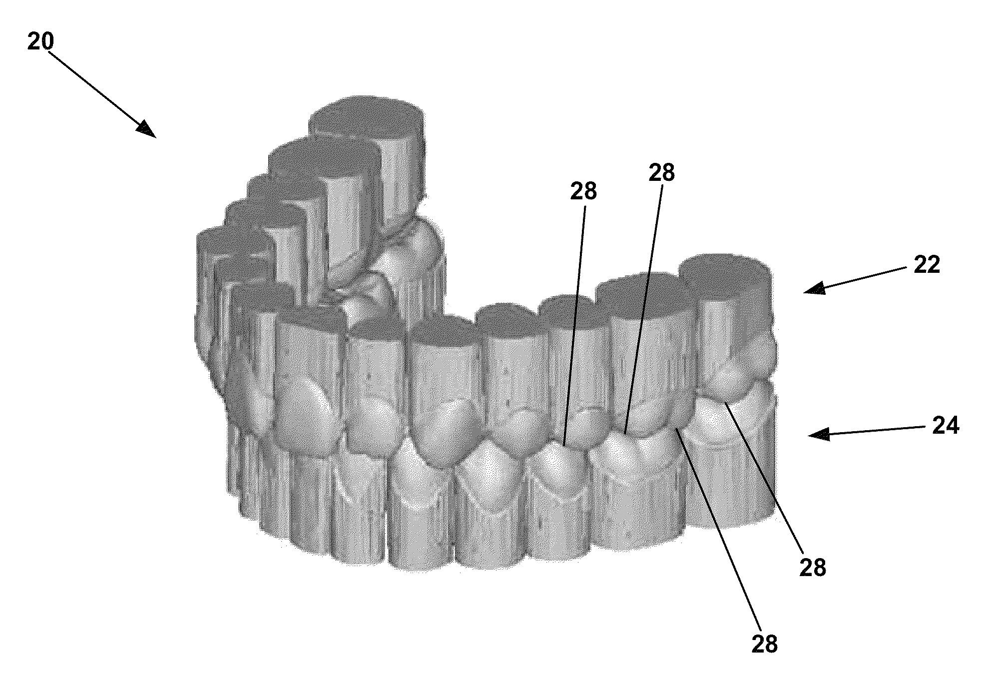 System and method for evaluating orthodontic treatment