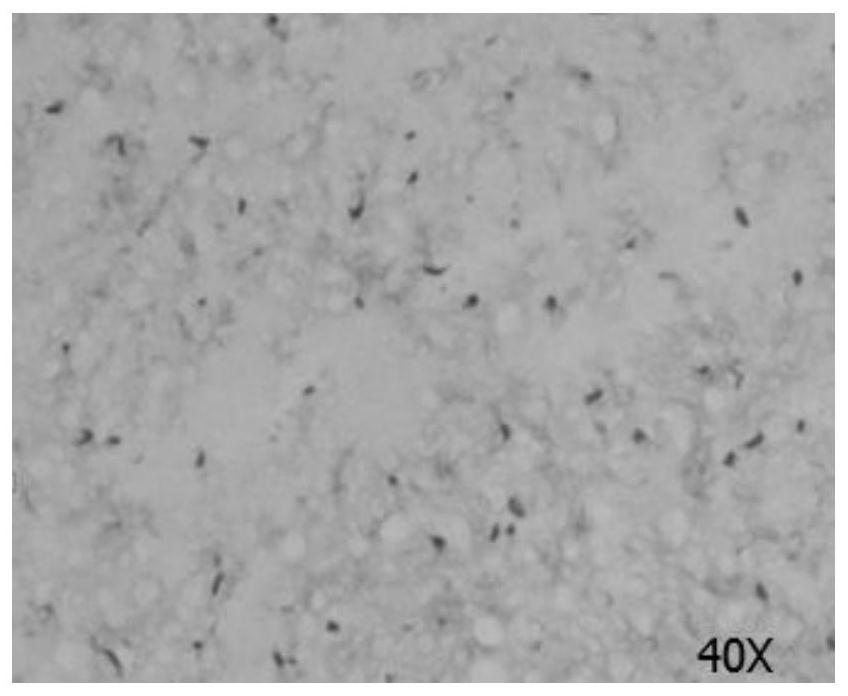 Preparation and cryopreservation method and application of human placental amniotic membrane and decidua tissue