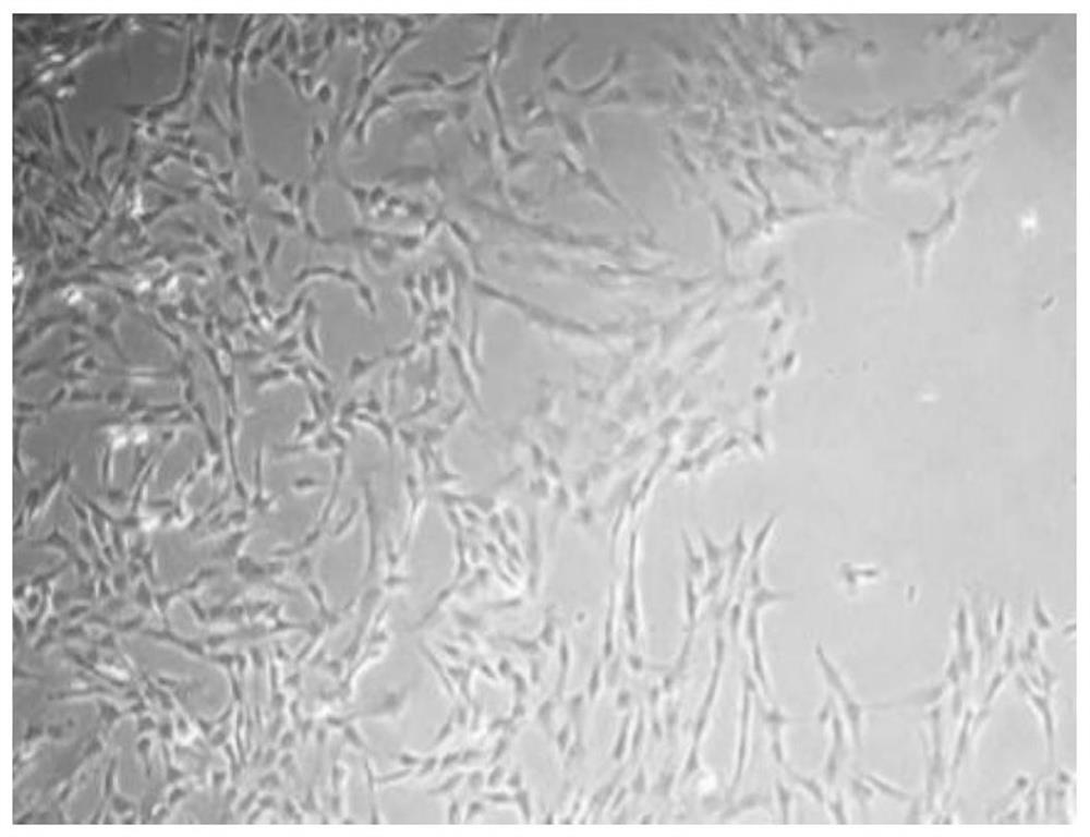 Preparation and cryopreservation method and application of human placental amniotic membrane and decidua tissue