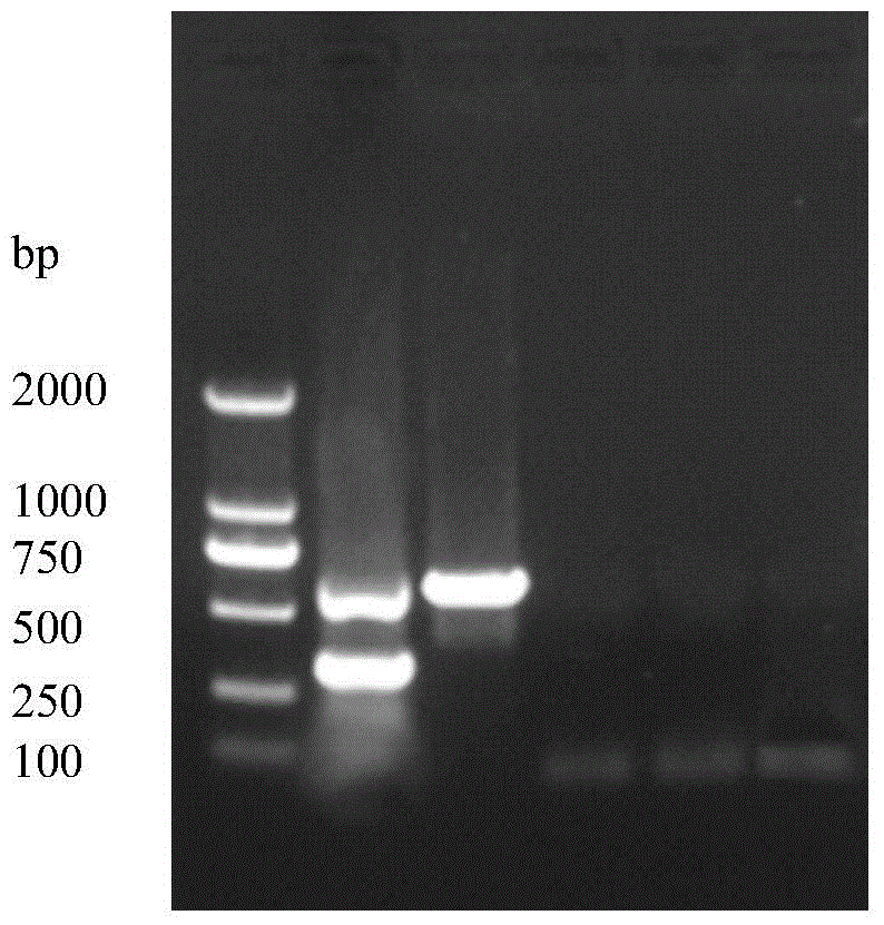 Primers and detection kits for differential diagnosis of strong and weak strains of porcine epidemic diarrhea virus