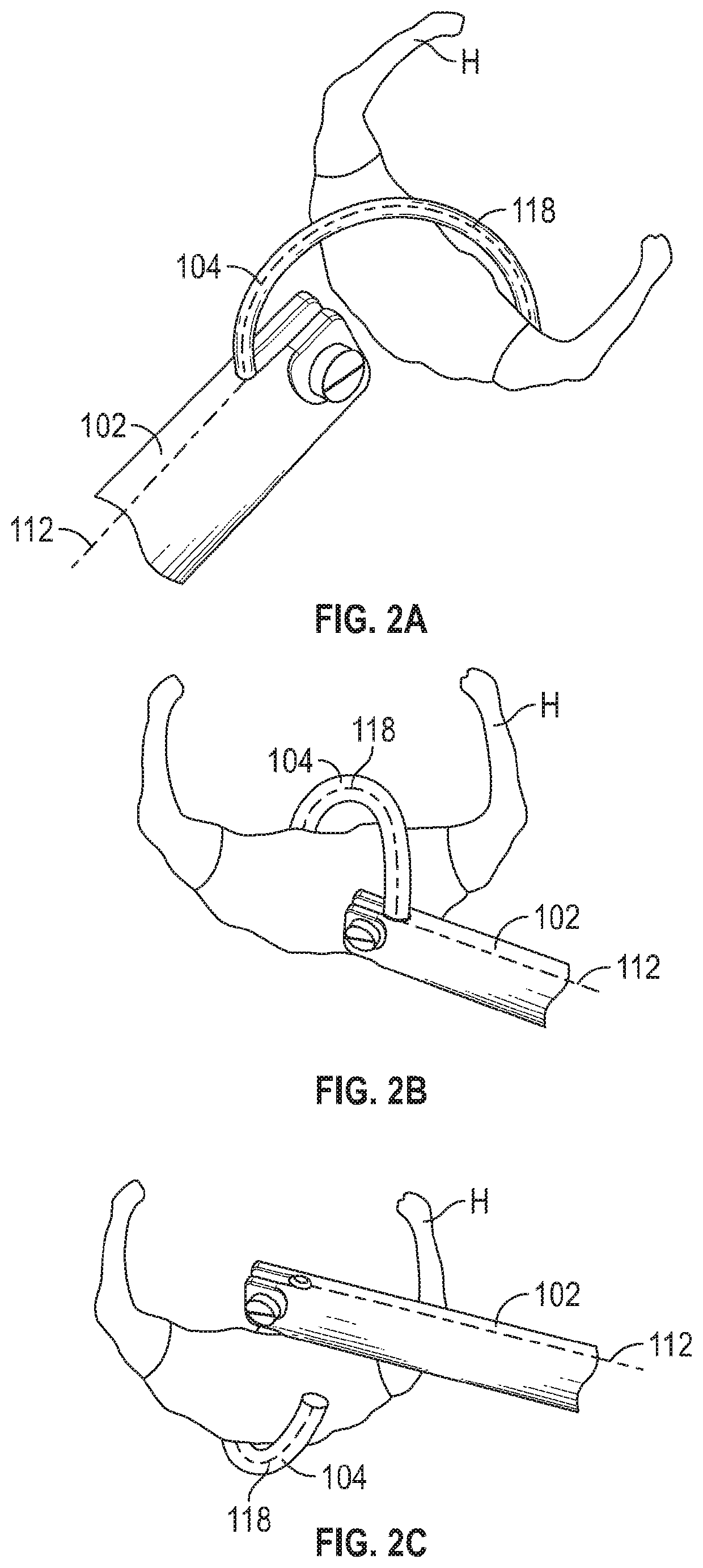 Suture passer systems and methods for tongue or other tissue suspension and compression