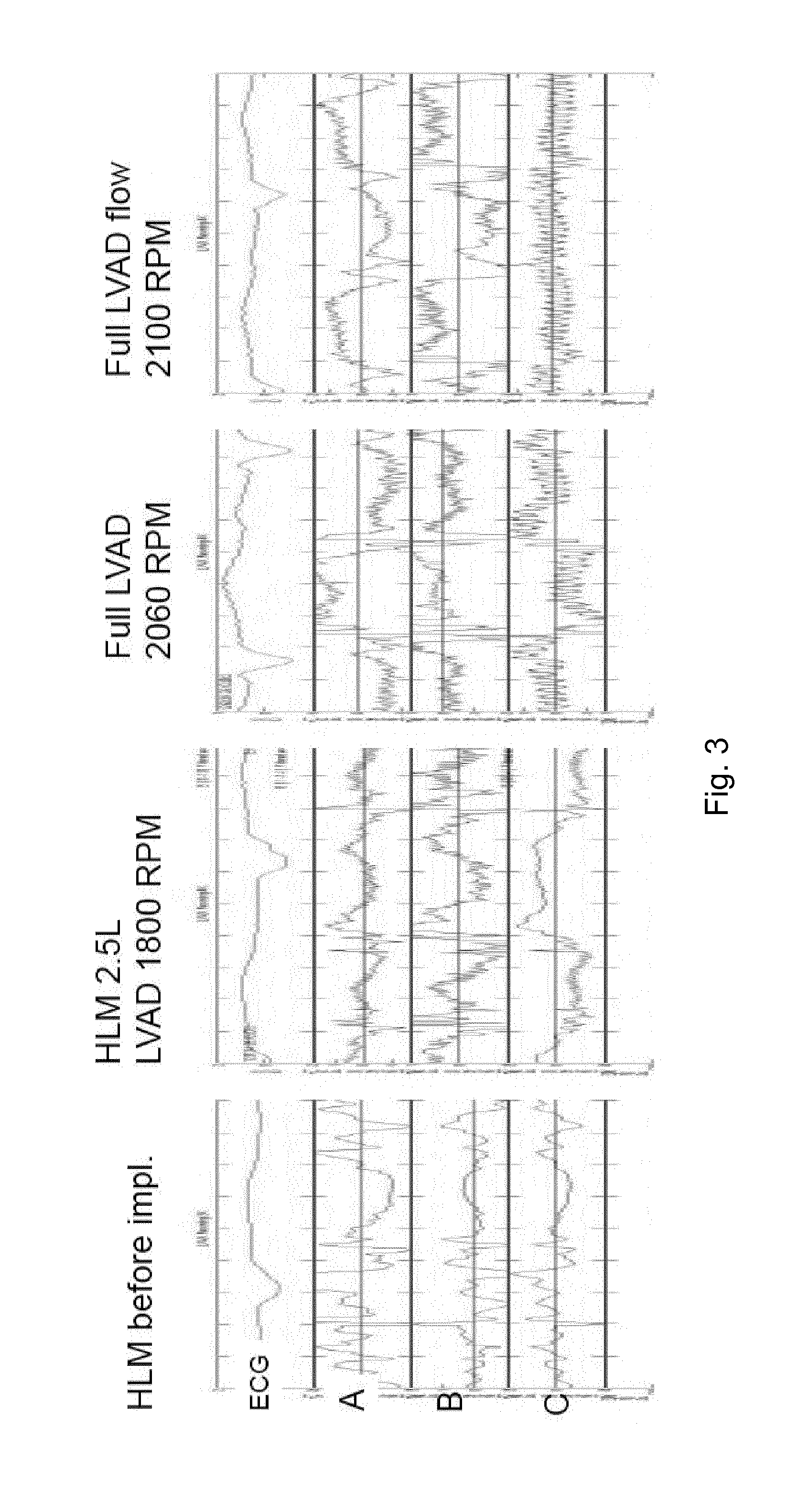 Monitoring of a cardiac assist device