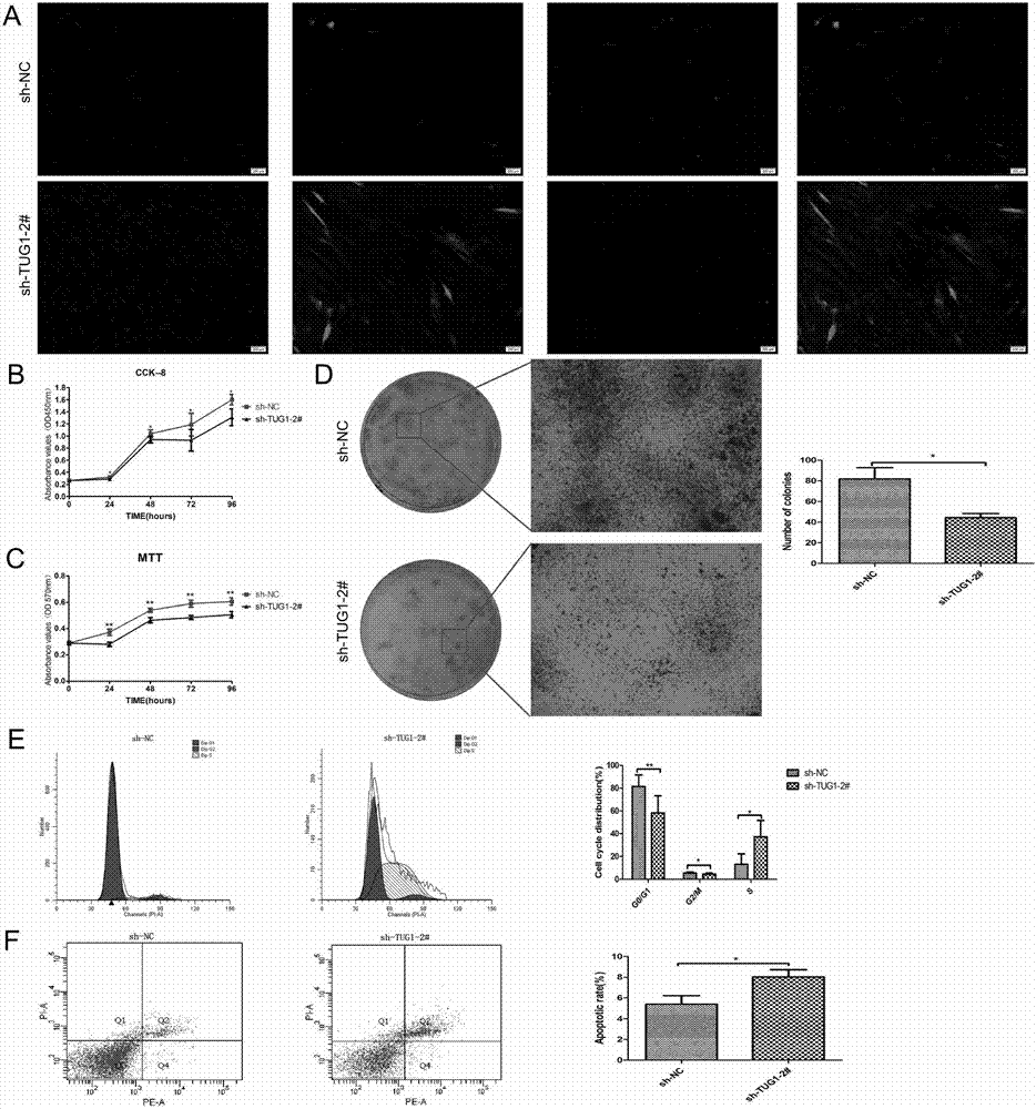 Application of LncRNA-TUG1 in preparation of drug for regulating and controlling dryness maintenance capacity of periodontal ligament stem cells
