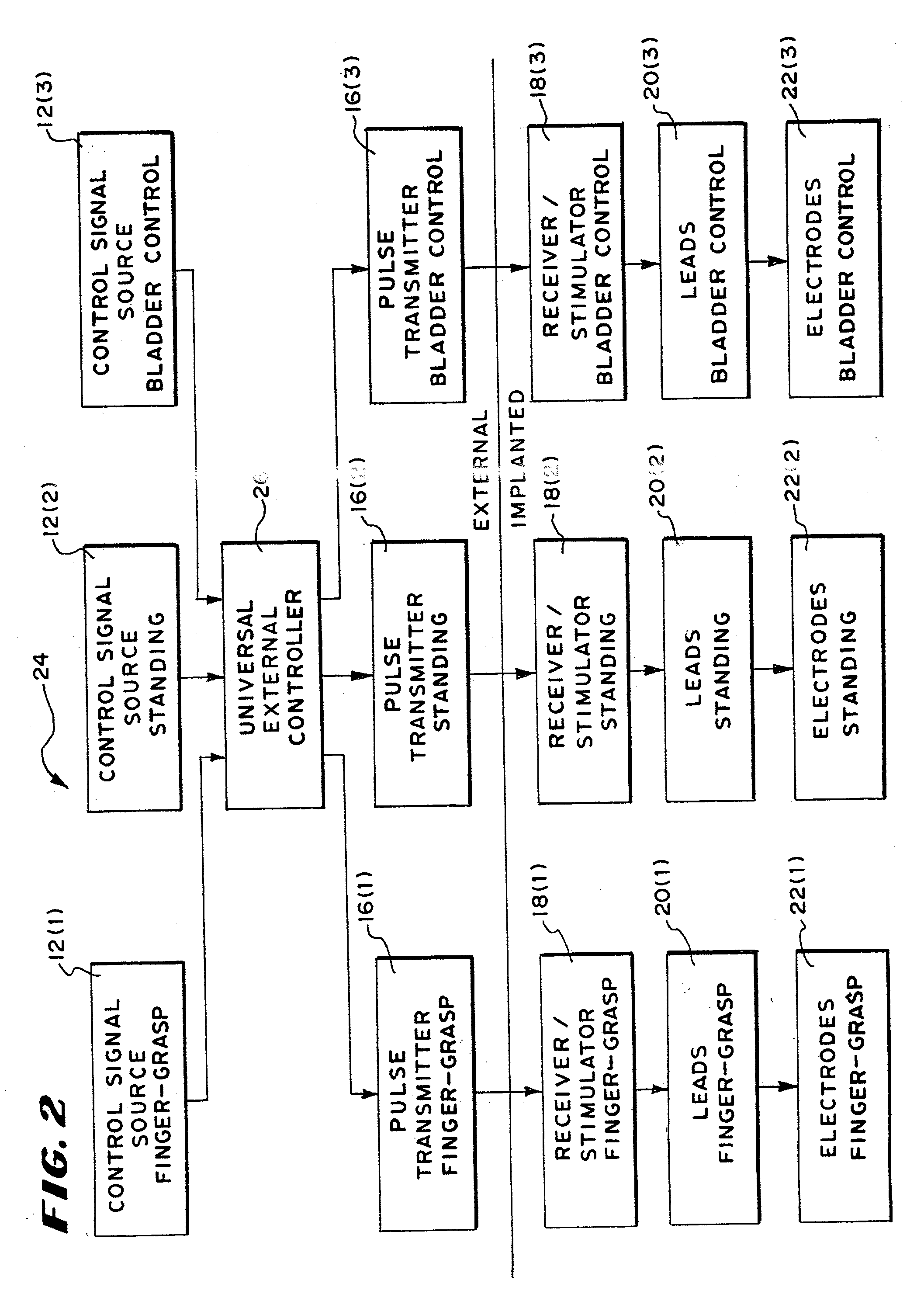 Systems and methods for performing prosthetic or therapeutic neuromuscular stimulation using a universal external controller accommodating different control inputs and/or different control outputs