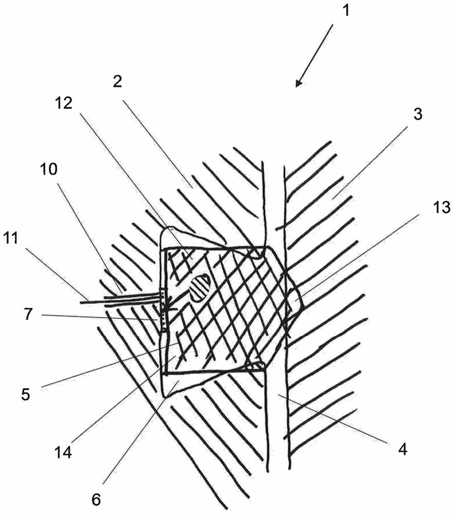 Sealing device and sealing element