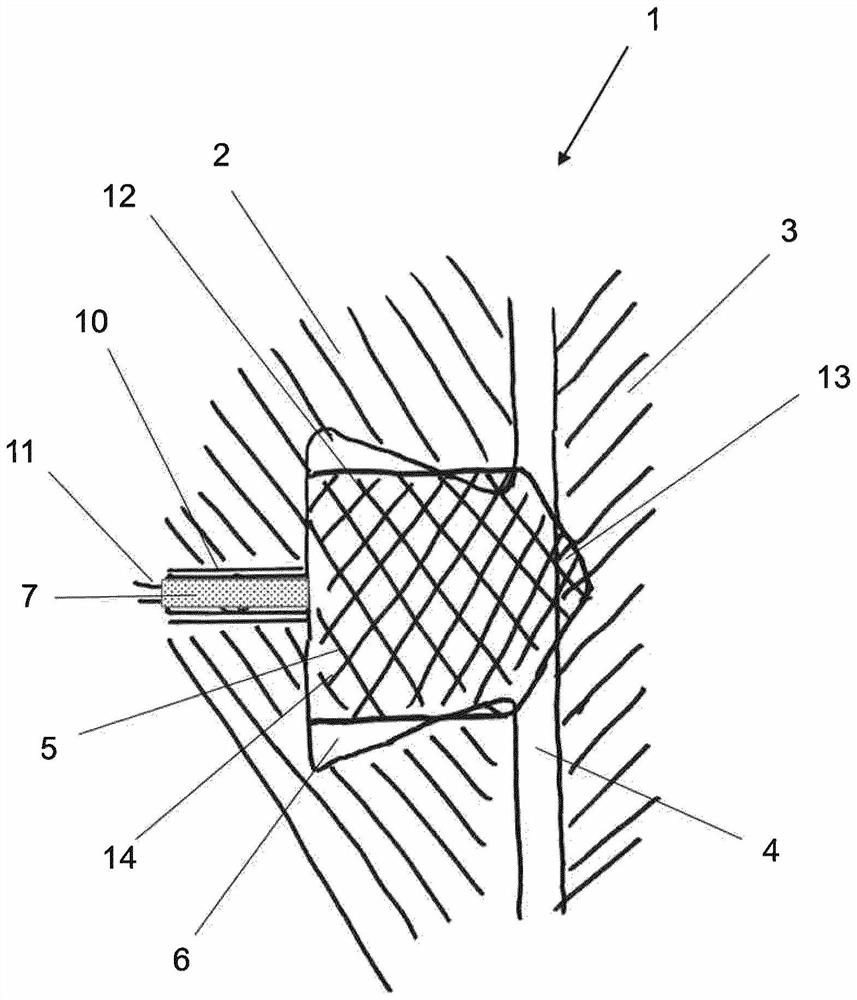 Sealing device and sealing element