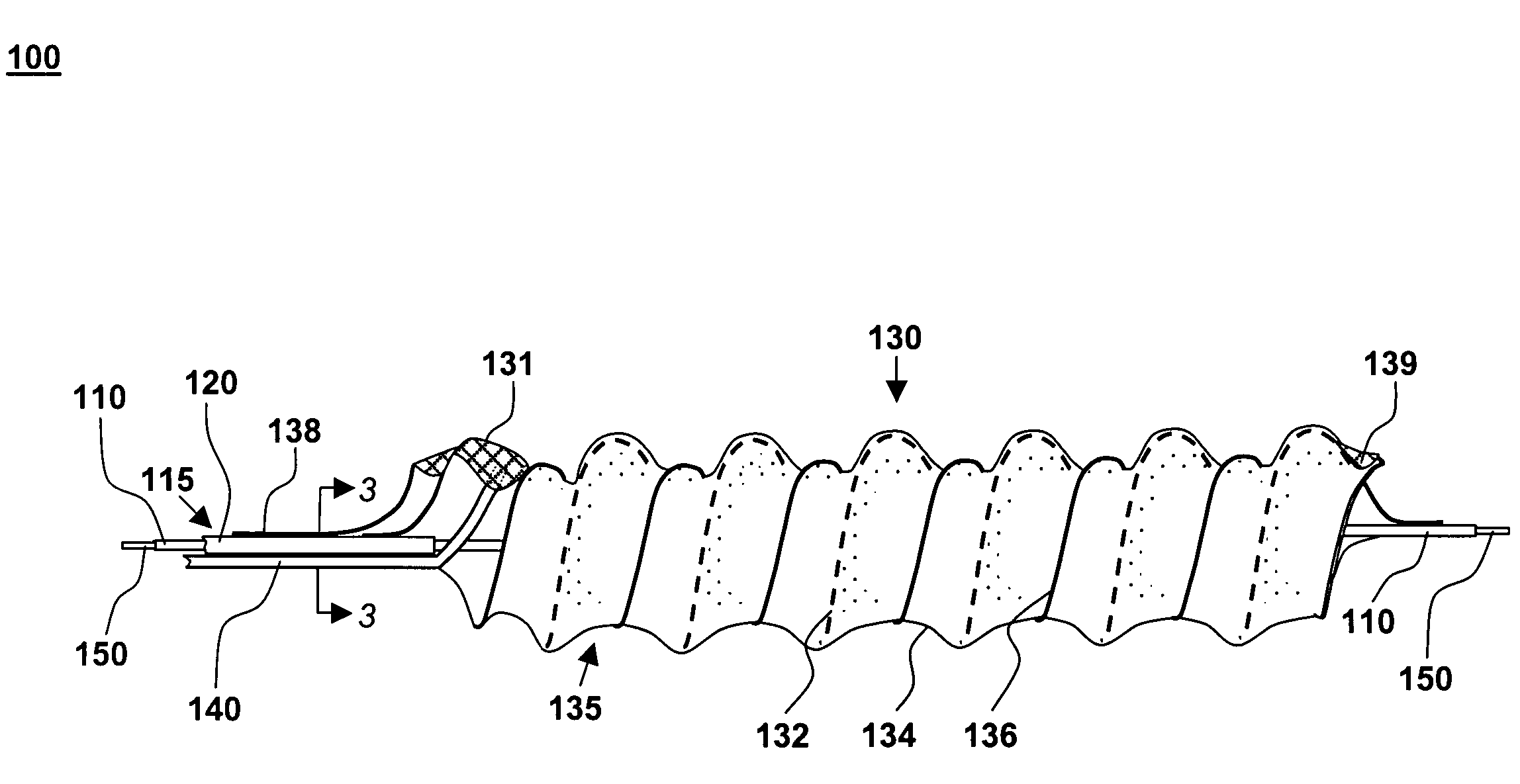 Catheter-based, dual coil photopolymerization system