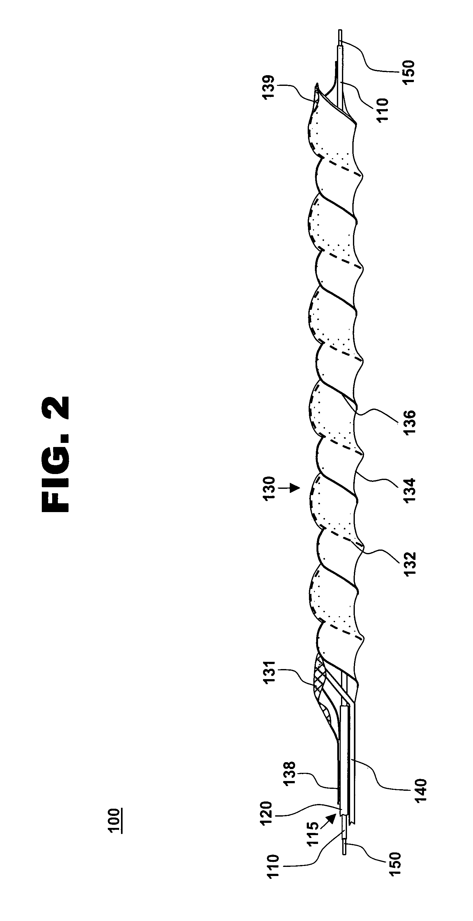 Catheter-based, dual coil photopolymerization system