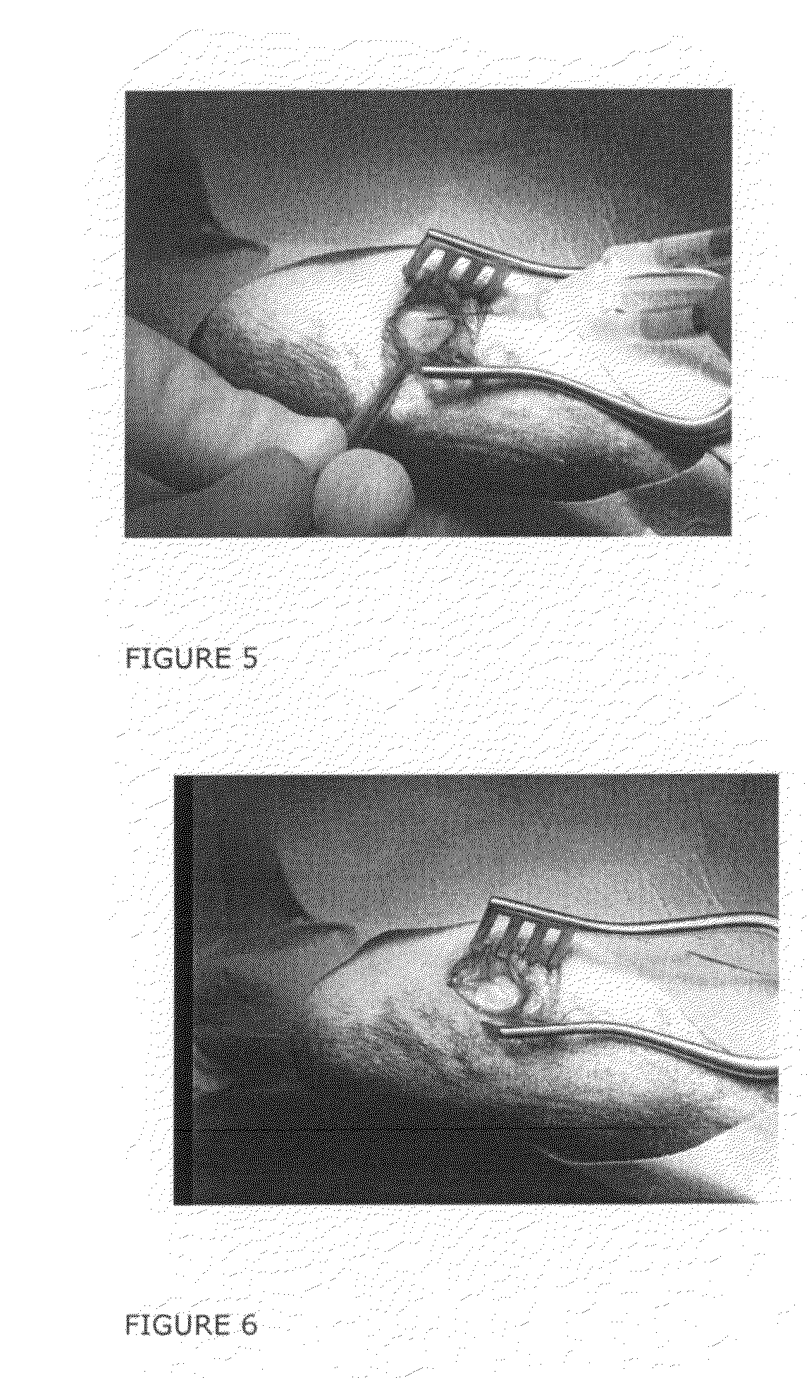 Method for Cell Implantation