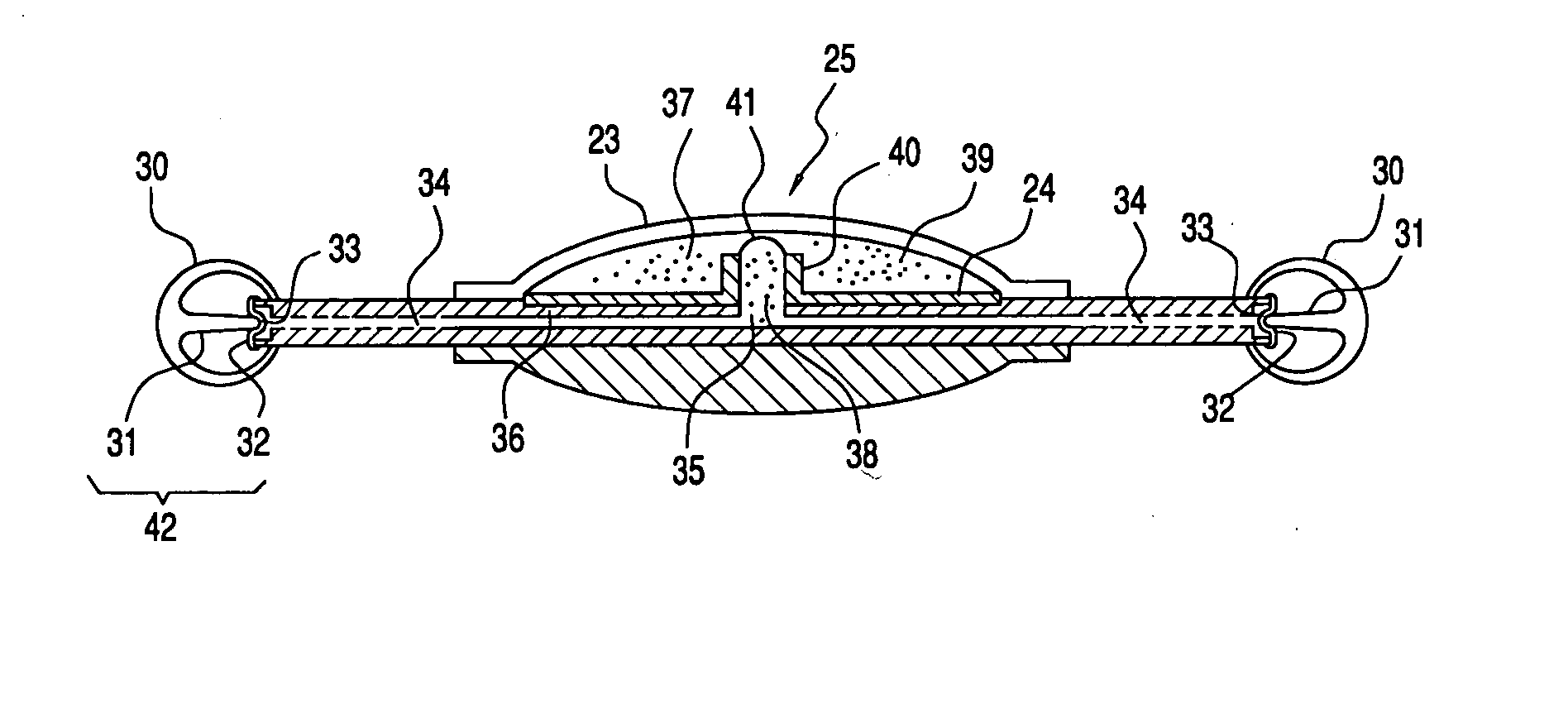 Accommodating intraocular lens system utilizing direct force transfer from zonules and method of use