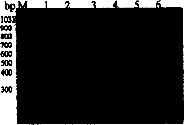 Ant CD20 chimeric antibody