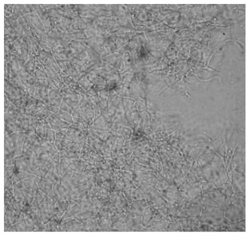 Preparation and application of a strain of Streptomyces alboniger for disease prevention and growth promotion and its metabolites