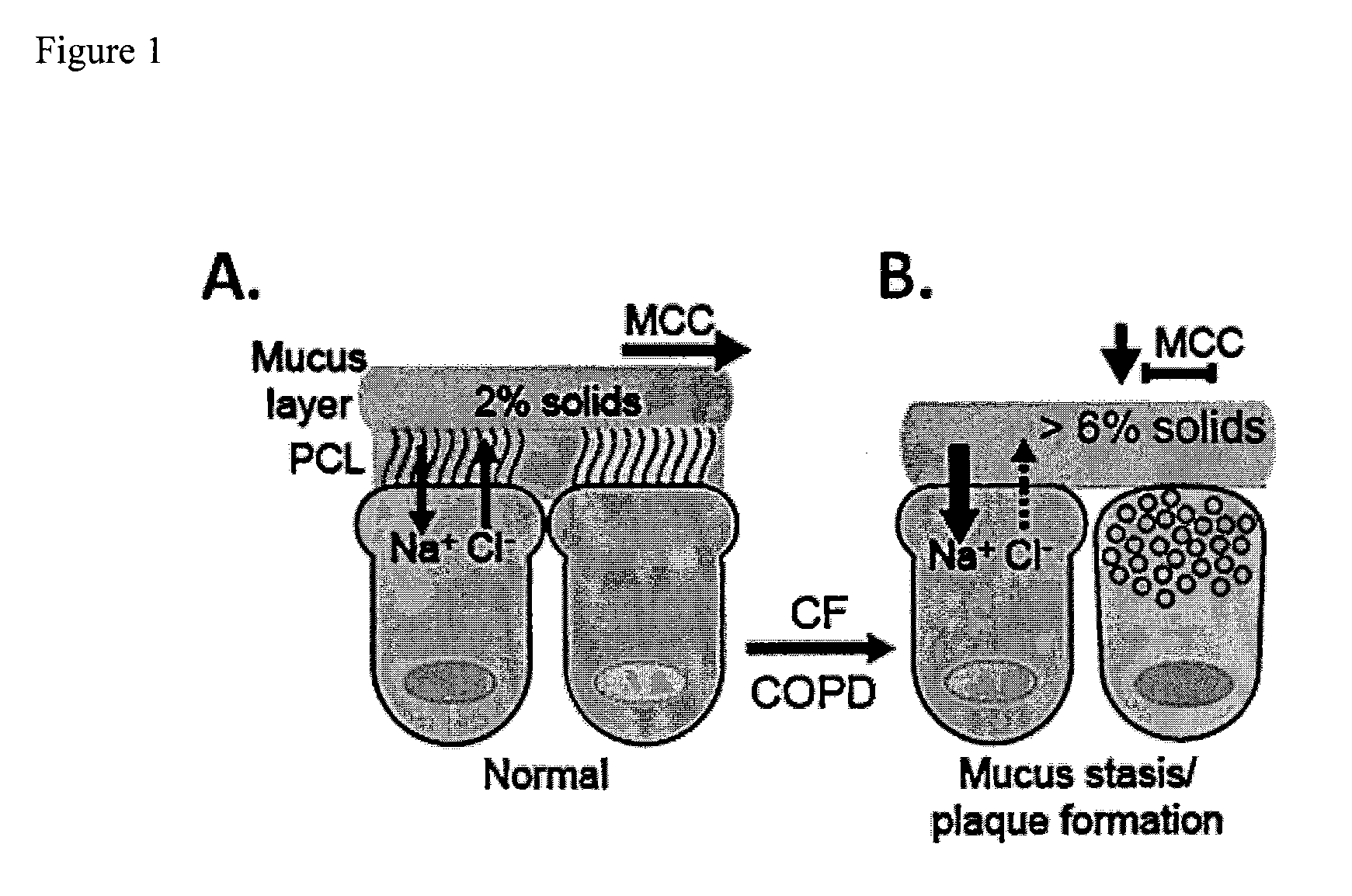 Dithiol mucolytic agents