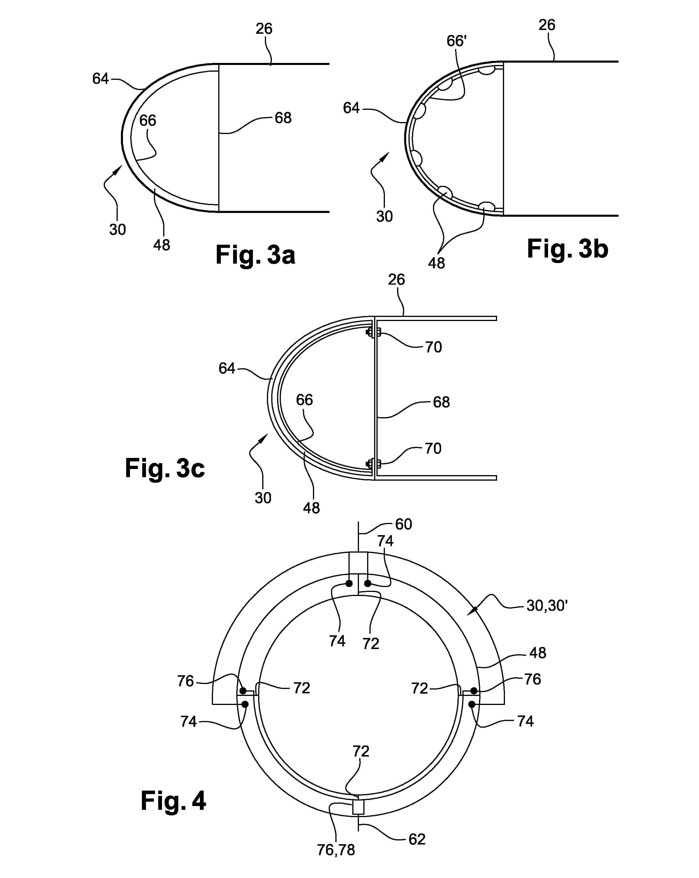 Circuit for de-icing an air inlet lip of an aircraft propulsion assembly