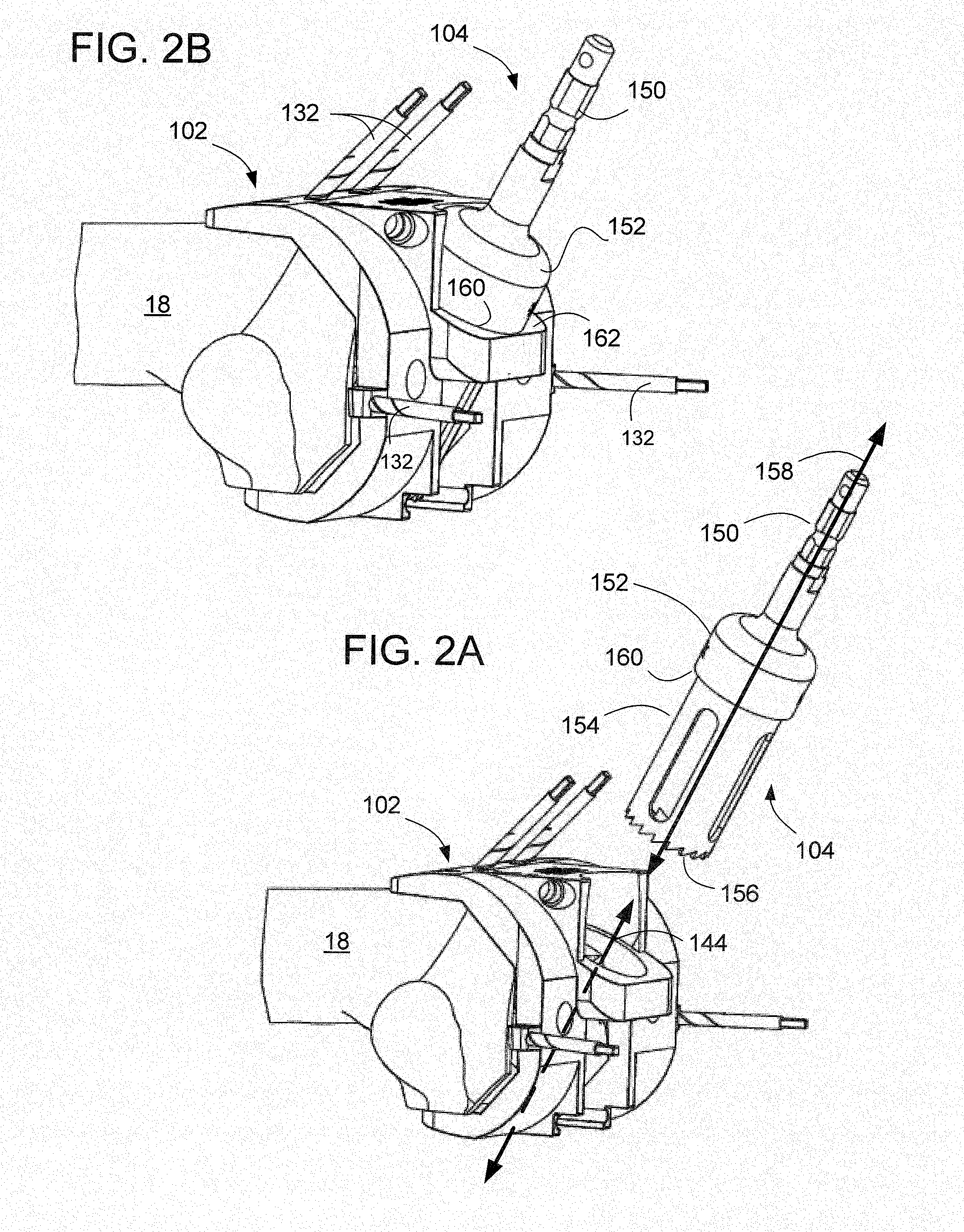 Methods And Apparatus For Preparing An Intercondylar Area Of A Distal Femur