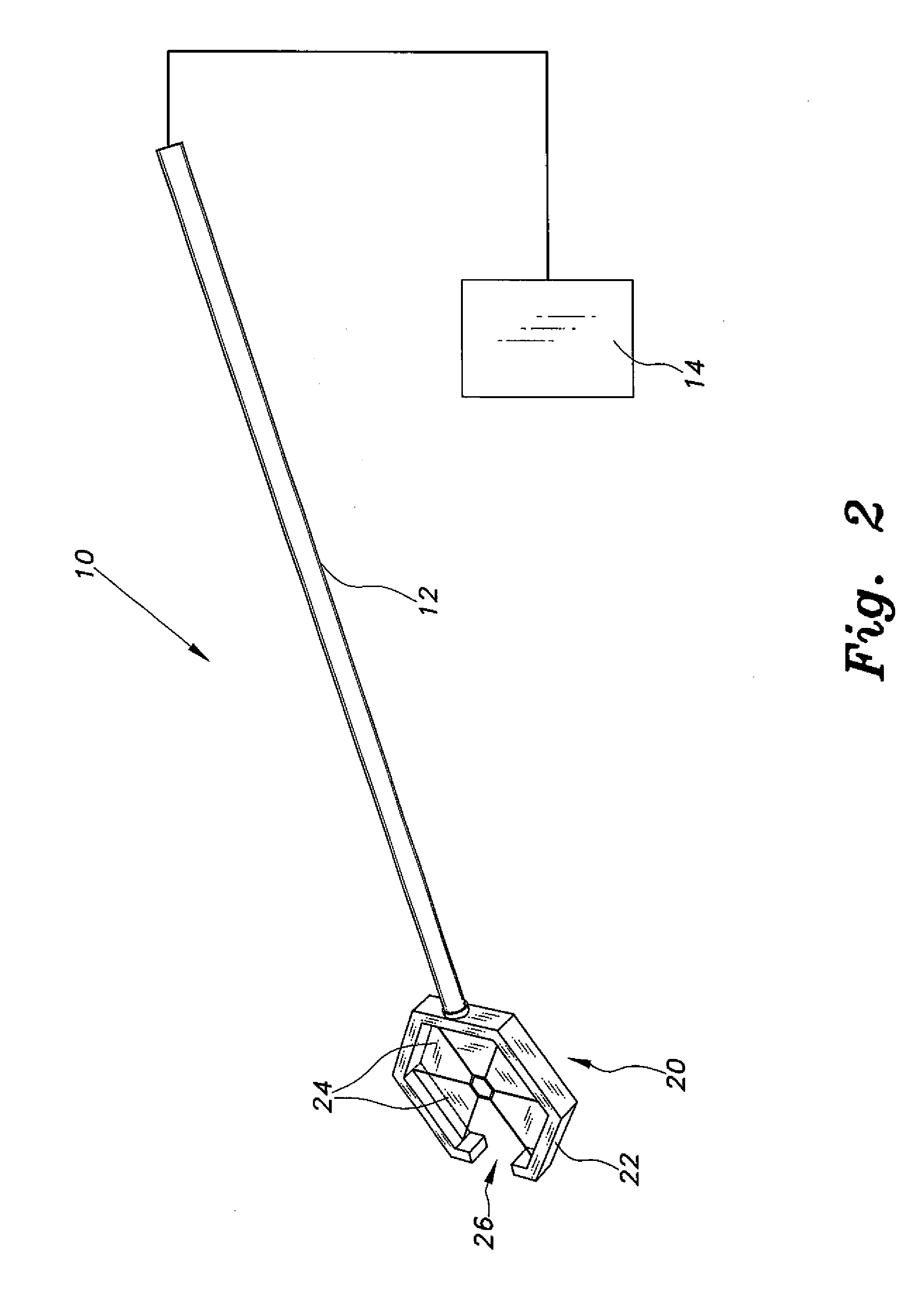 Minimally invasive pulmonary artery band