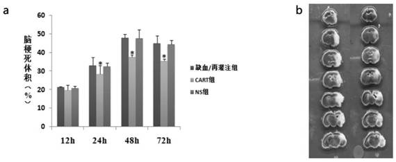 Application of CART to preparation of ischemic brain injury neuroprotective agent medicine
