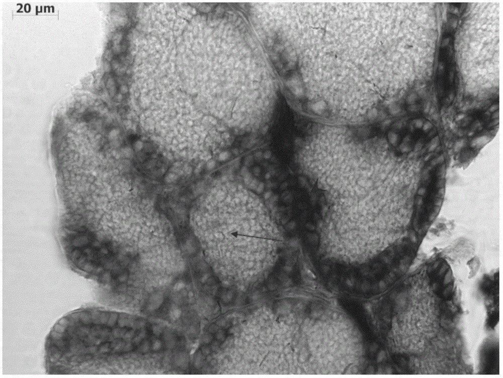 Method of flounder juvenile gonad mRNA in-situ hybridization