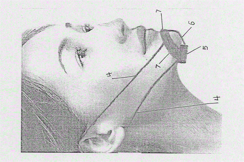 Anti-snoring method by surrounding jaw