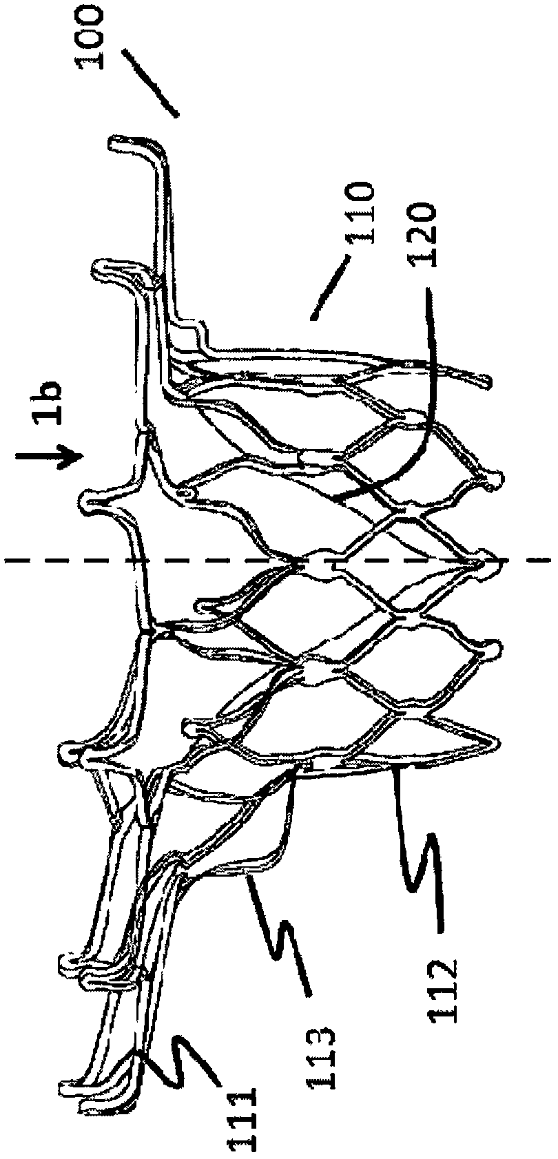 An asymmetric heart valve prosthesis