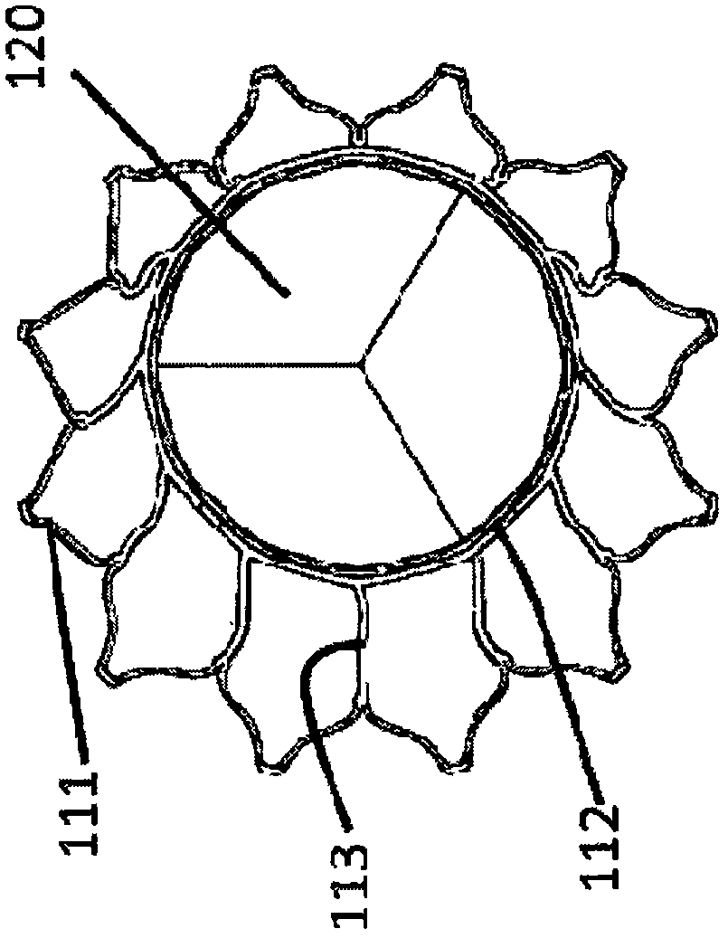 An asymmetric heart valve prosthesis