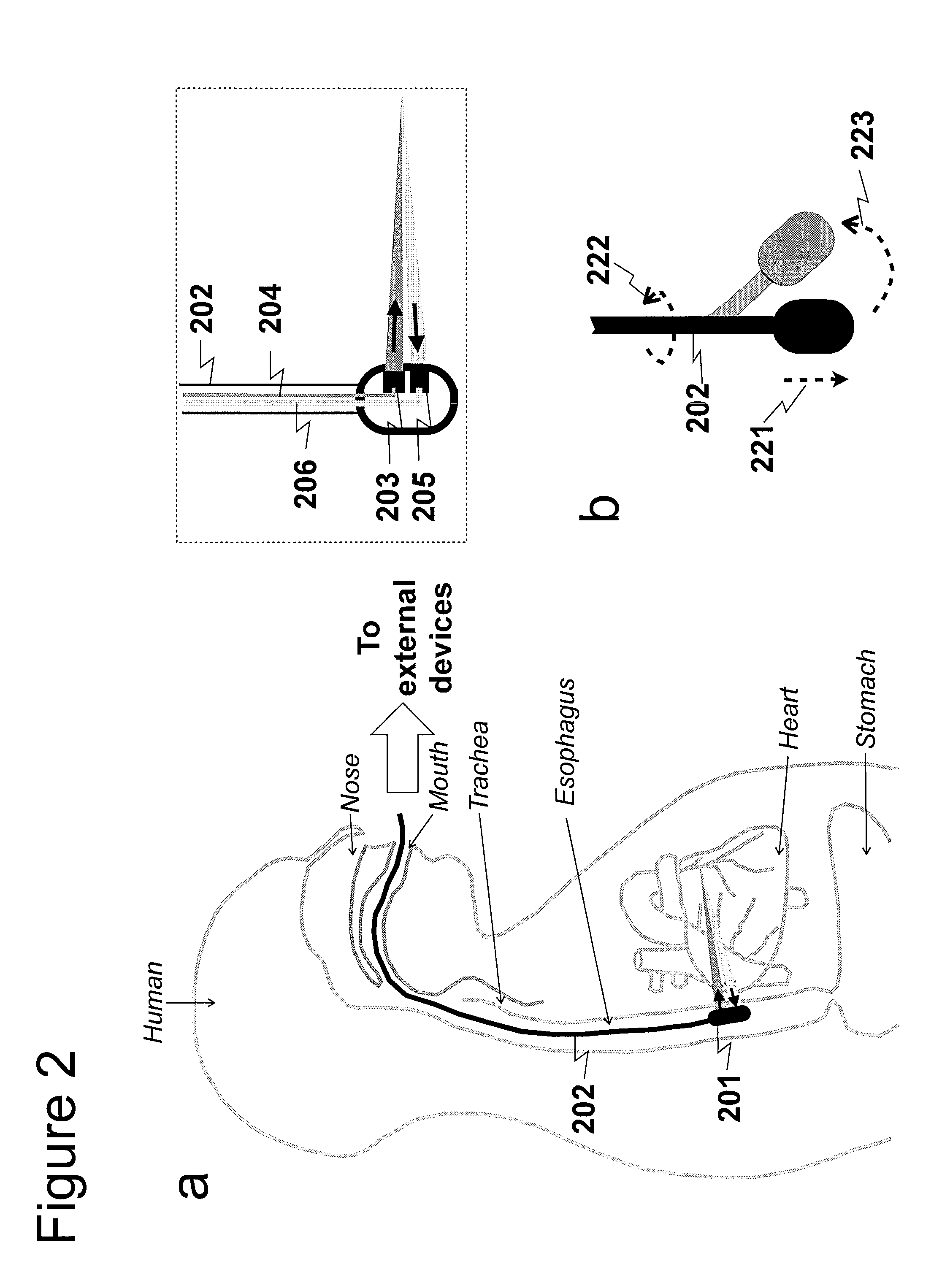 Apparatus, systems, methods and computer-accessible medium for analyzing information regarding cardiovascular diseases and functions