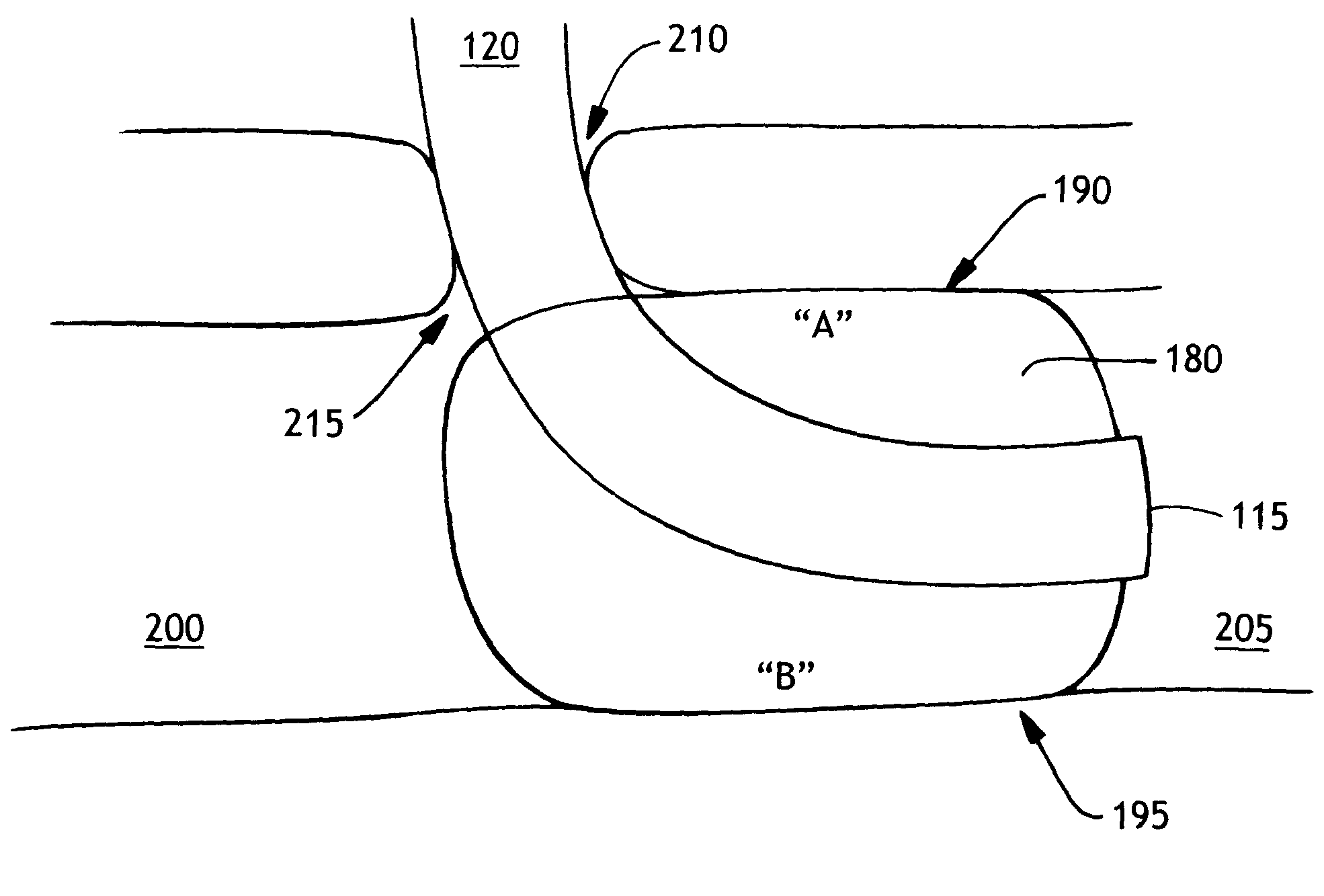 Method of making an improved balloon cuff tracheostomy tube