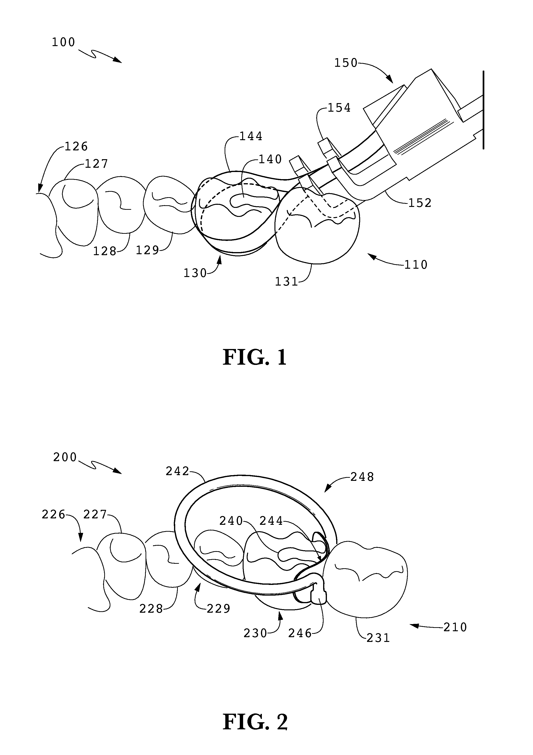 System for Maintaining Tooth Contact During Interproximal Dental Restoration