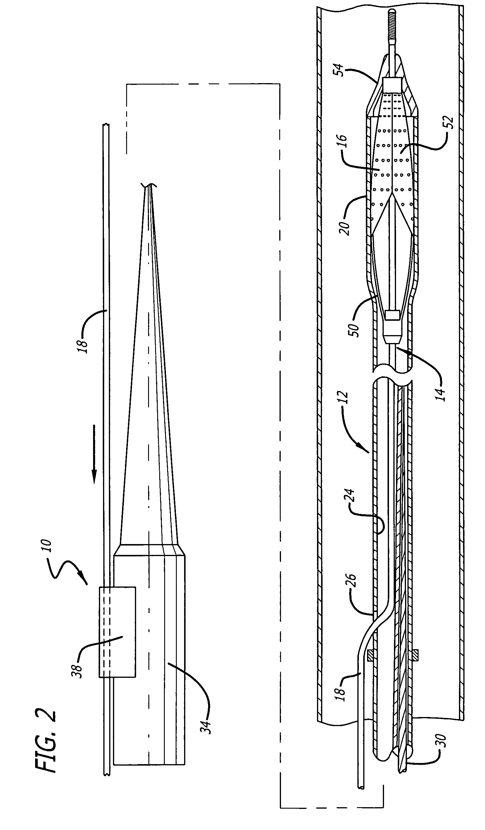 Guide wire locking mechanism for rapid exchange and other catheter systems