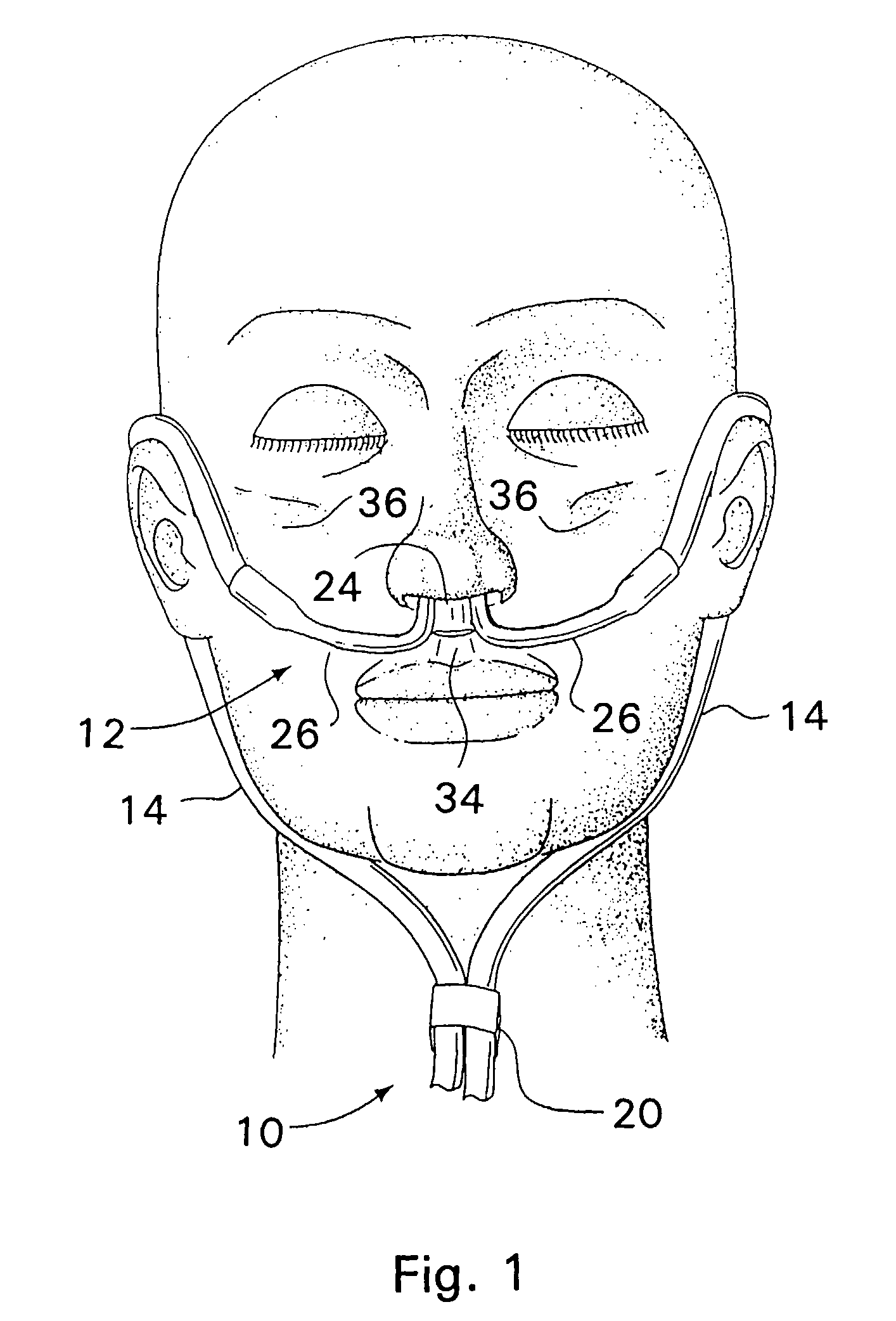 Respiratory therapy system including a nasal cannula assembly