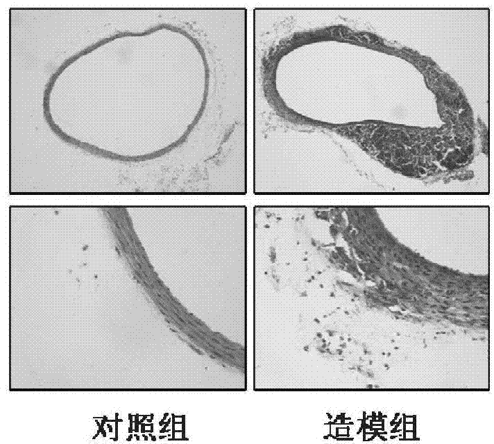 Establishing method and application of mouse aortic dissecting aneurysm model
