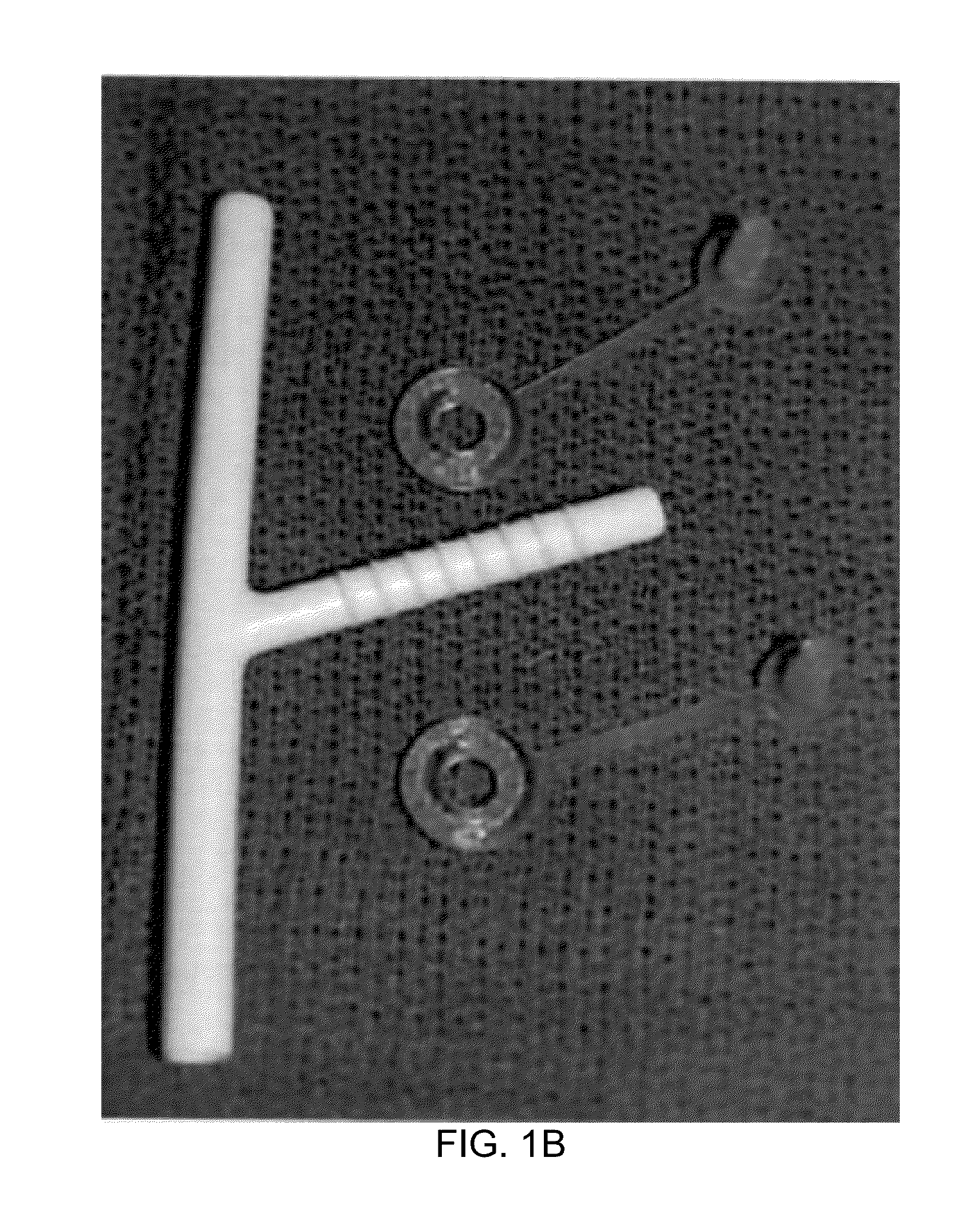 Bioresorbable laryngotracheal stent and methods of treatment