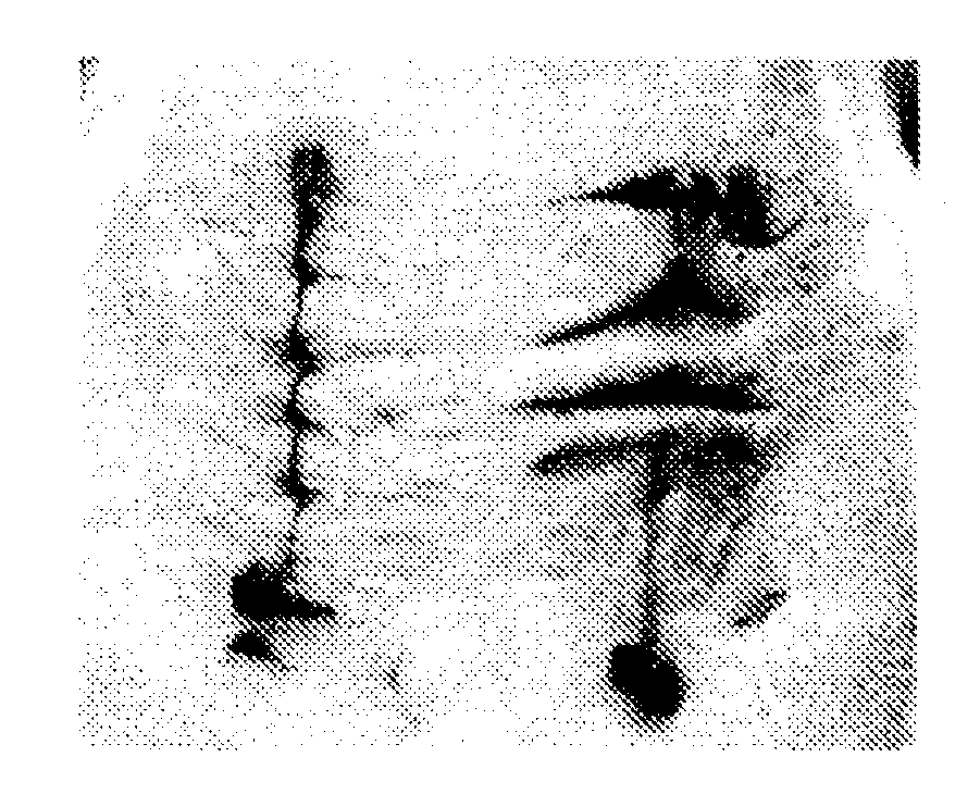 Biodegradable medical adhesive and preparation method and use thereof