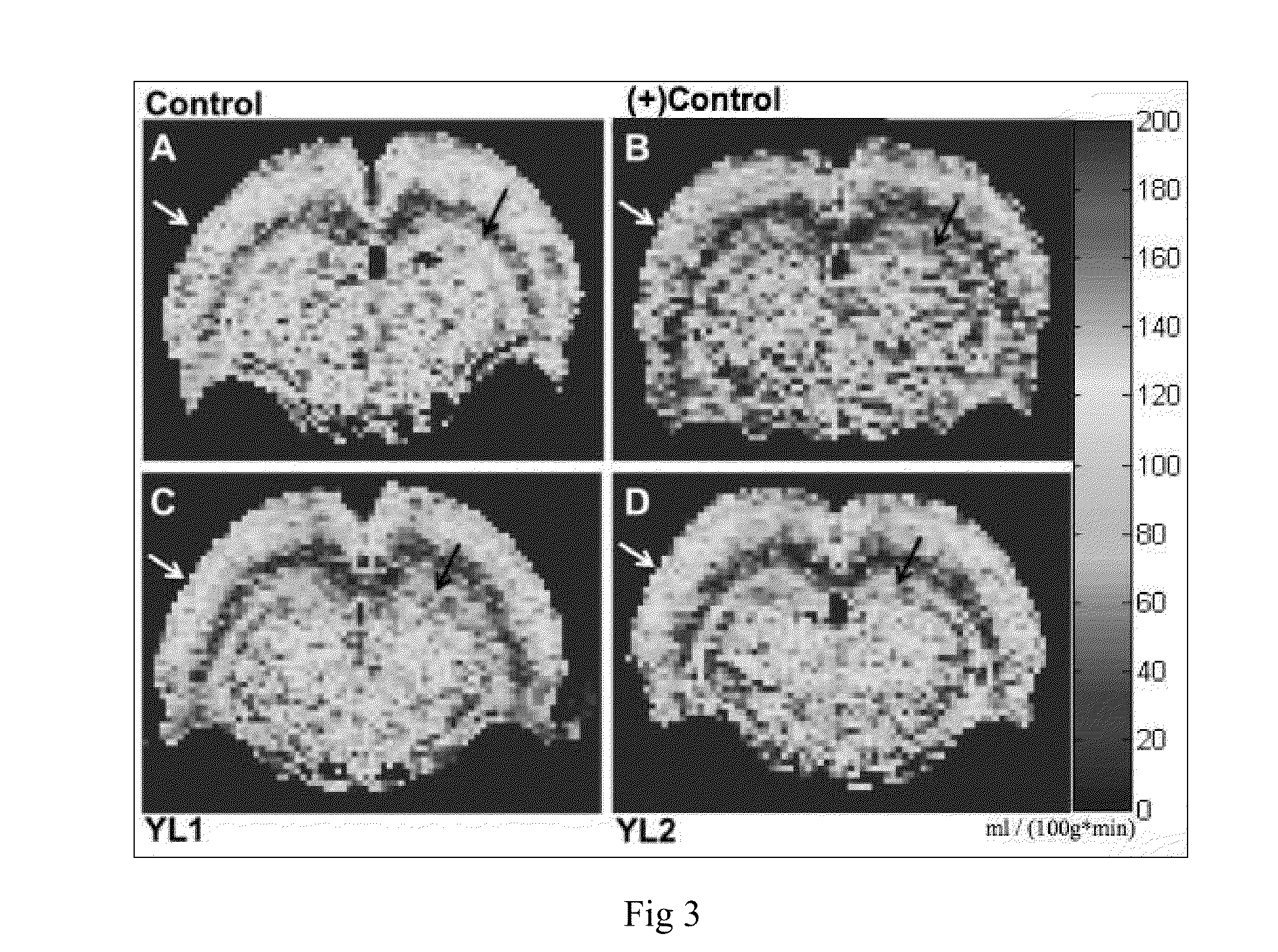 Method of improving hematological parameters and brain dysfunction with ganoderma tsugae extract