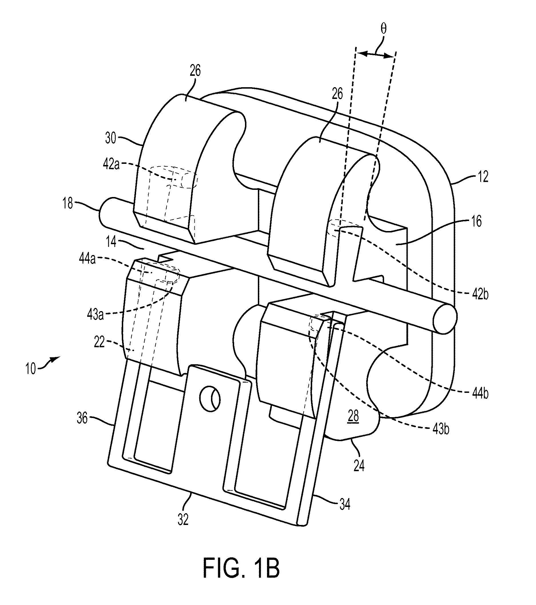 Orthodontic bracket with angled, curved shutter