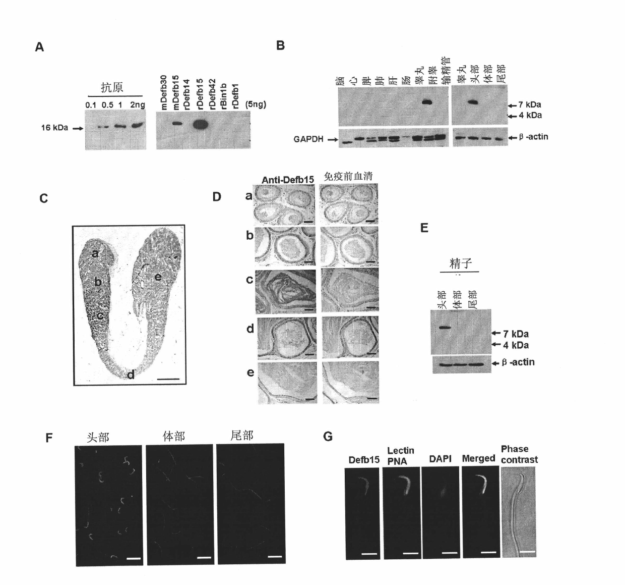 Beta-defensin 15 of specific antibacterial peptides of rat epididymis and application thereof