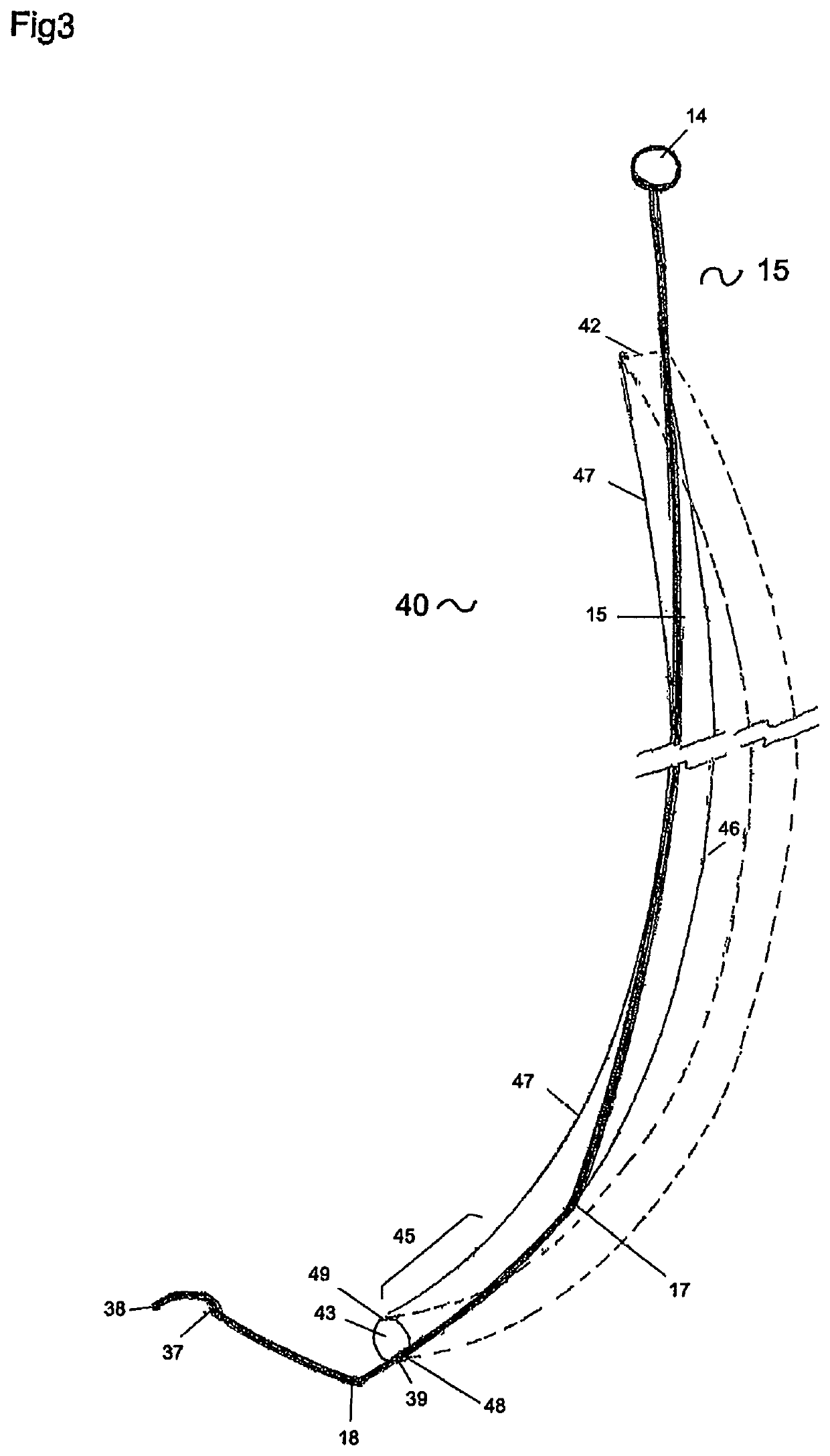 Tip adjustable stylet