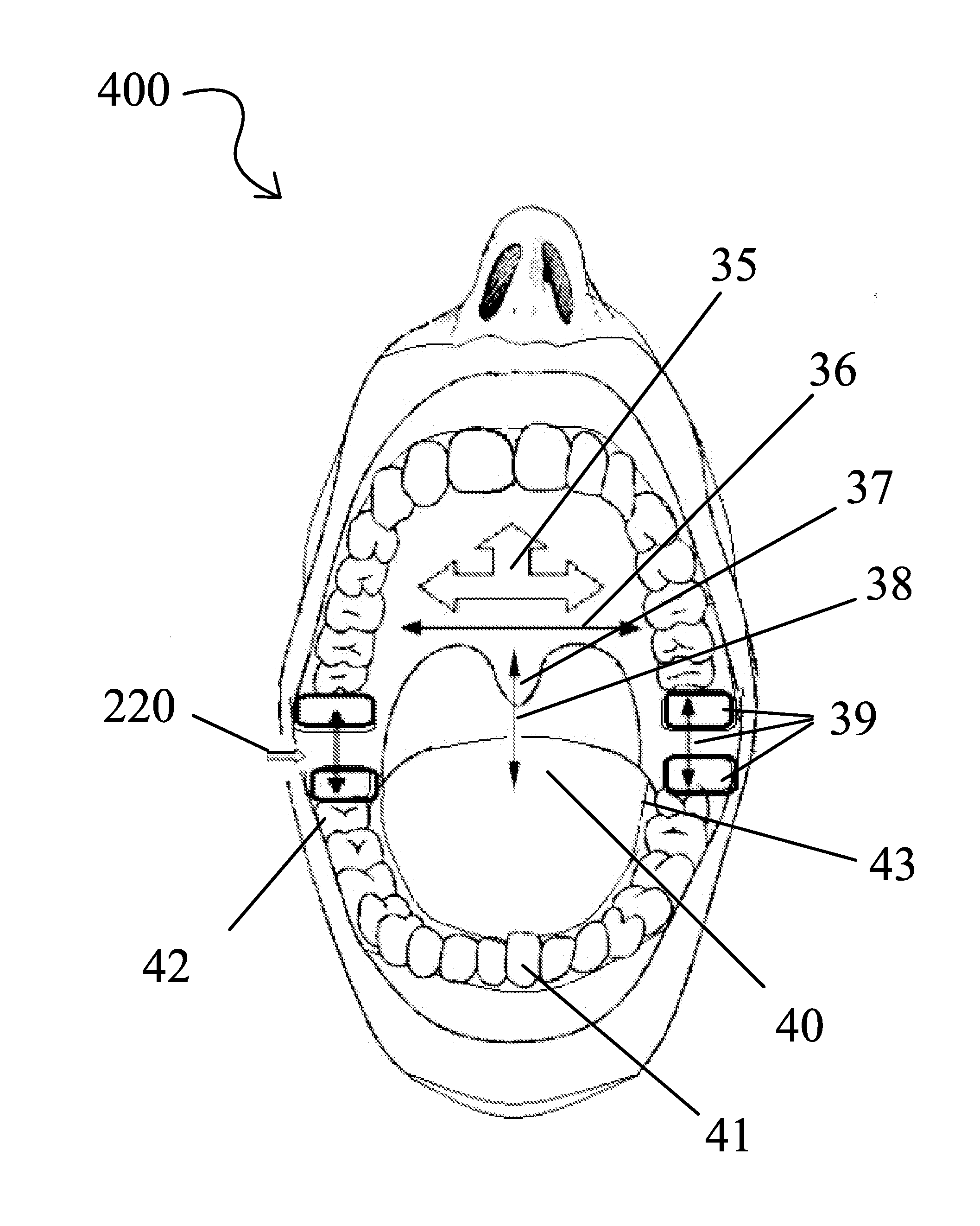 Snoring and obstructive sleep apnea prevention and treatment device